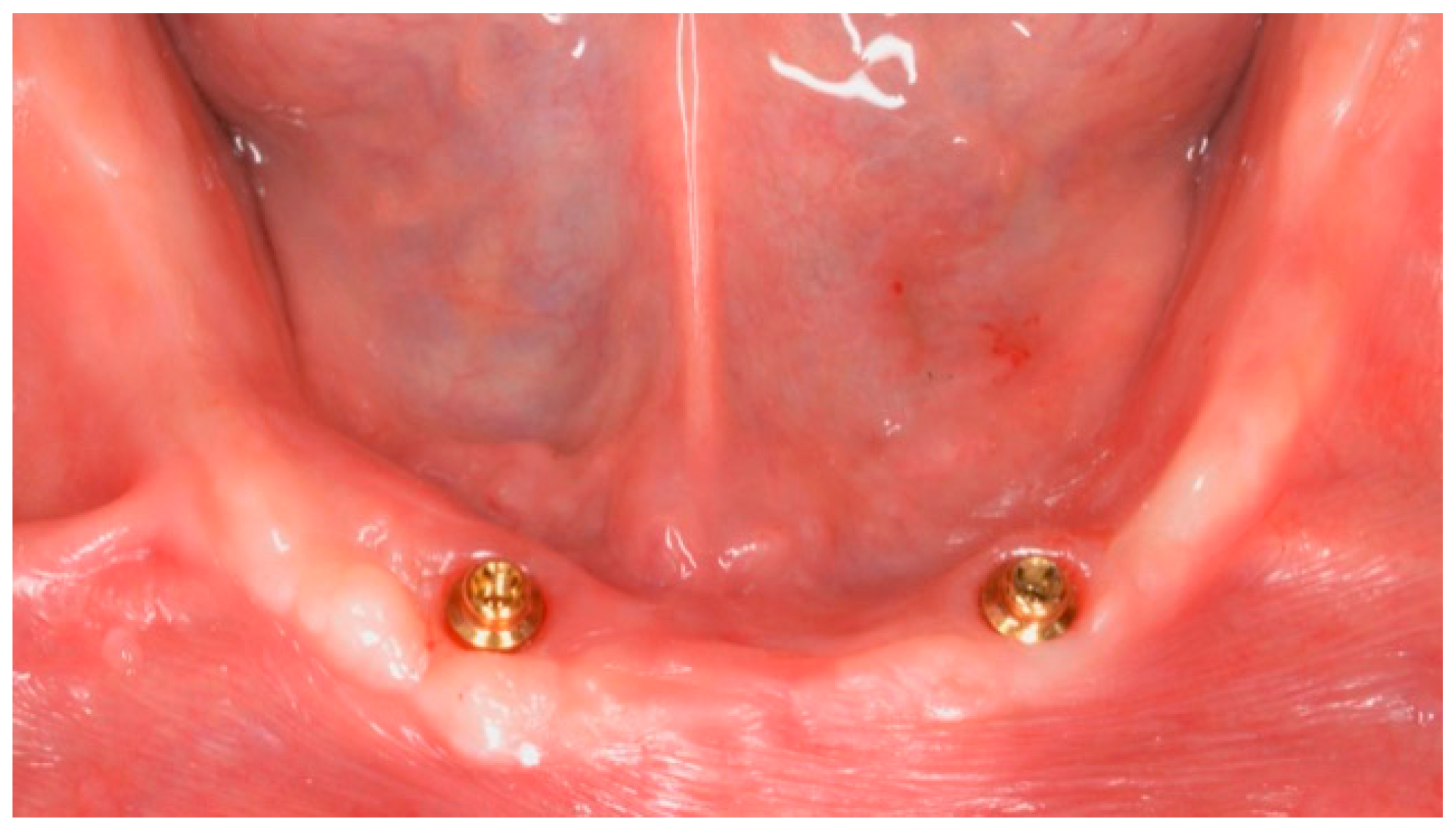 Dentistry 06 00071 g004