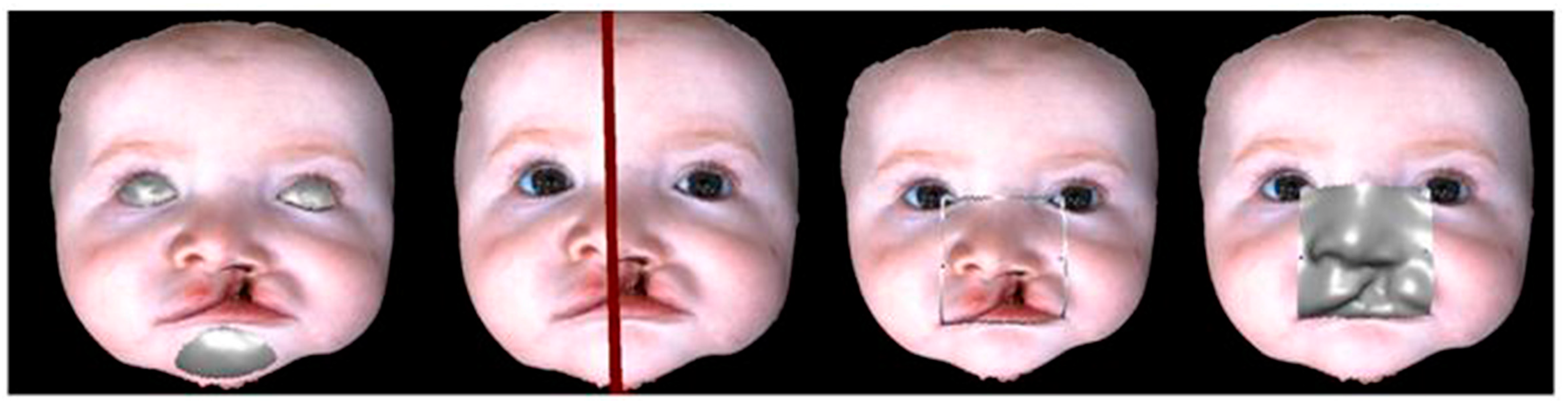 Dentistry 07 00027 g002 Dentistry 07 00027 g002