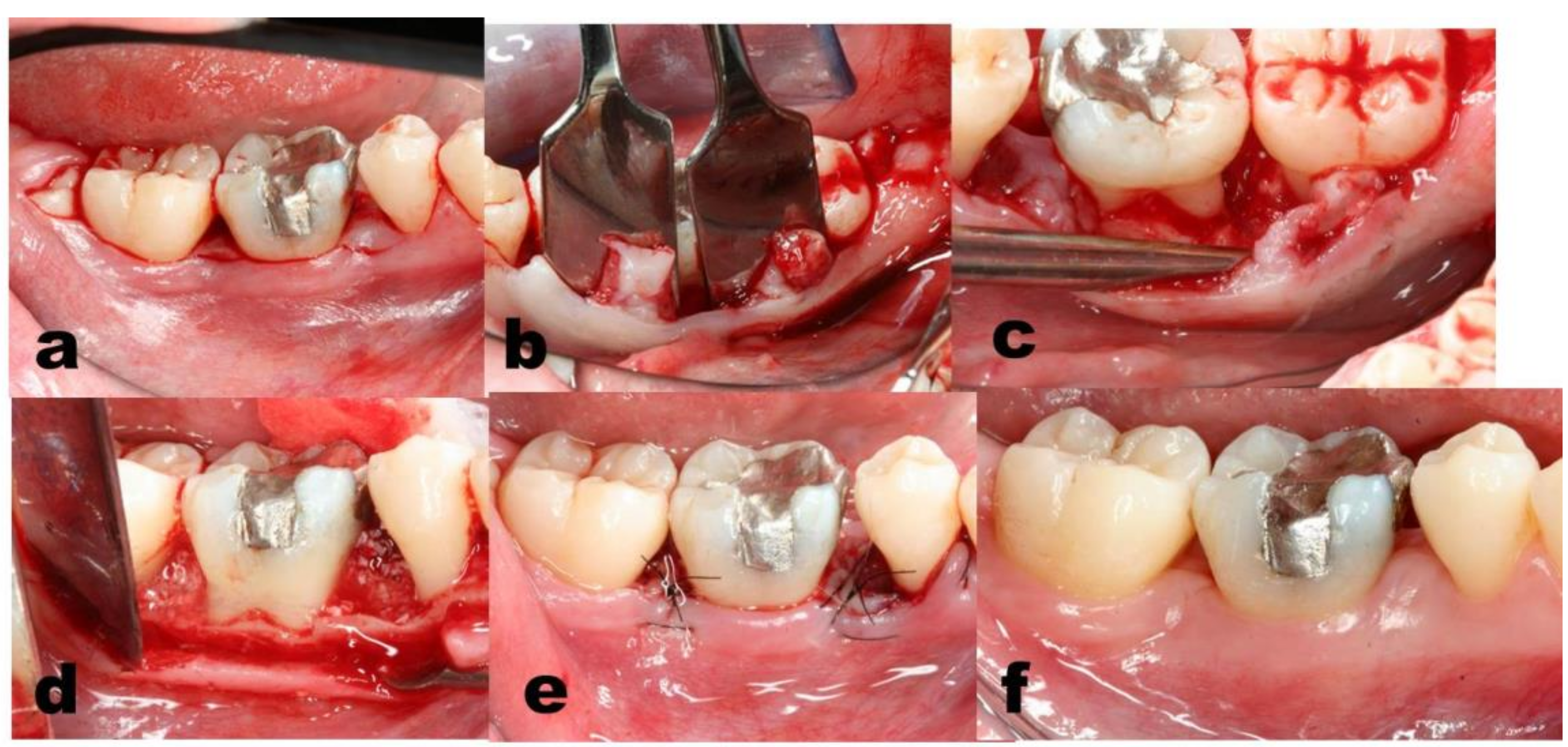 Dentistry 07 00029 g004