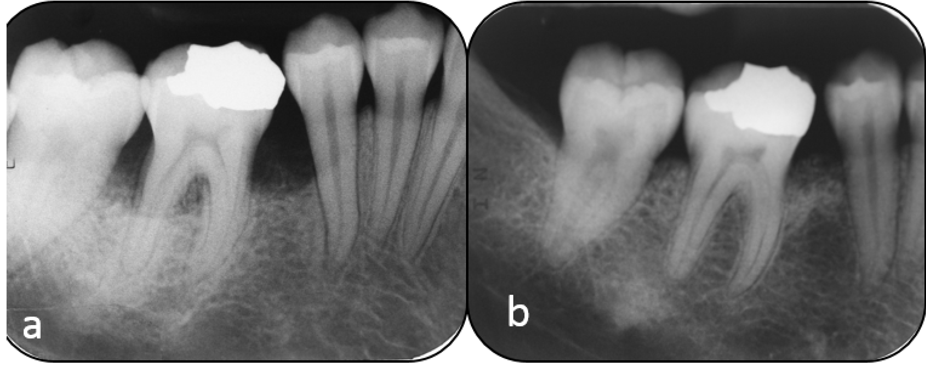 Dentistry 07 00029 g005