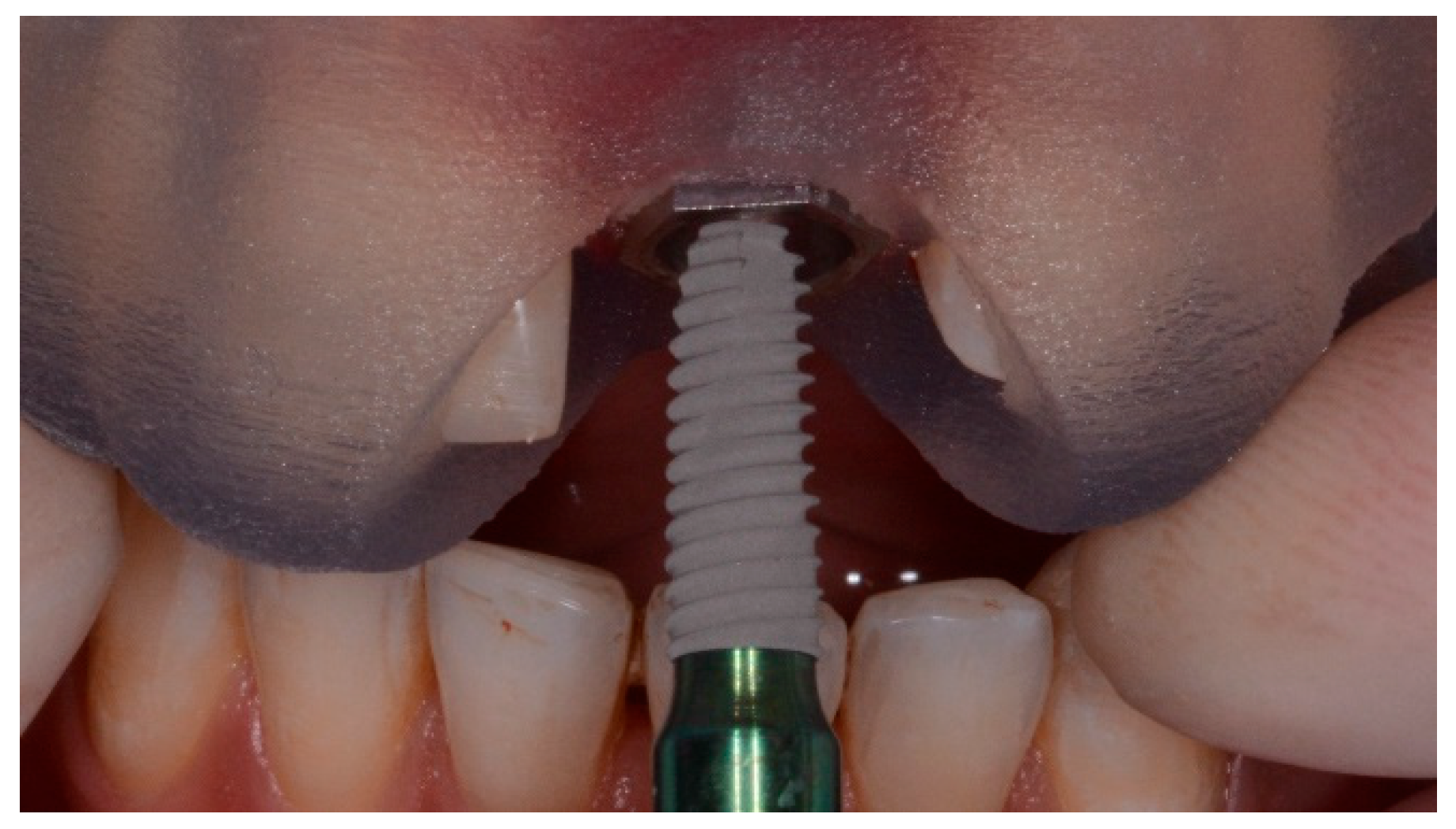 Dentistry 07 00041 g001 550