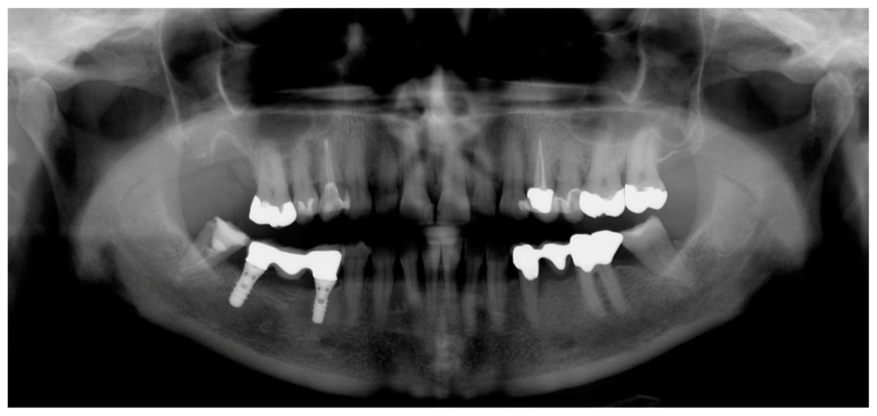 Dentistry 07 00050 g002 Dentistry 07 00050 g002