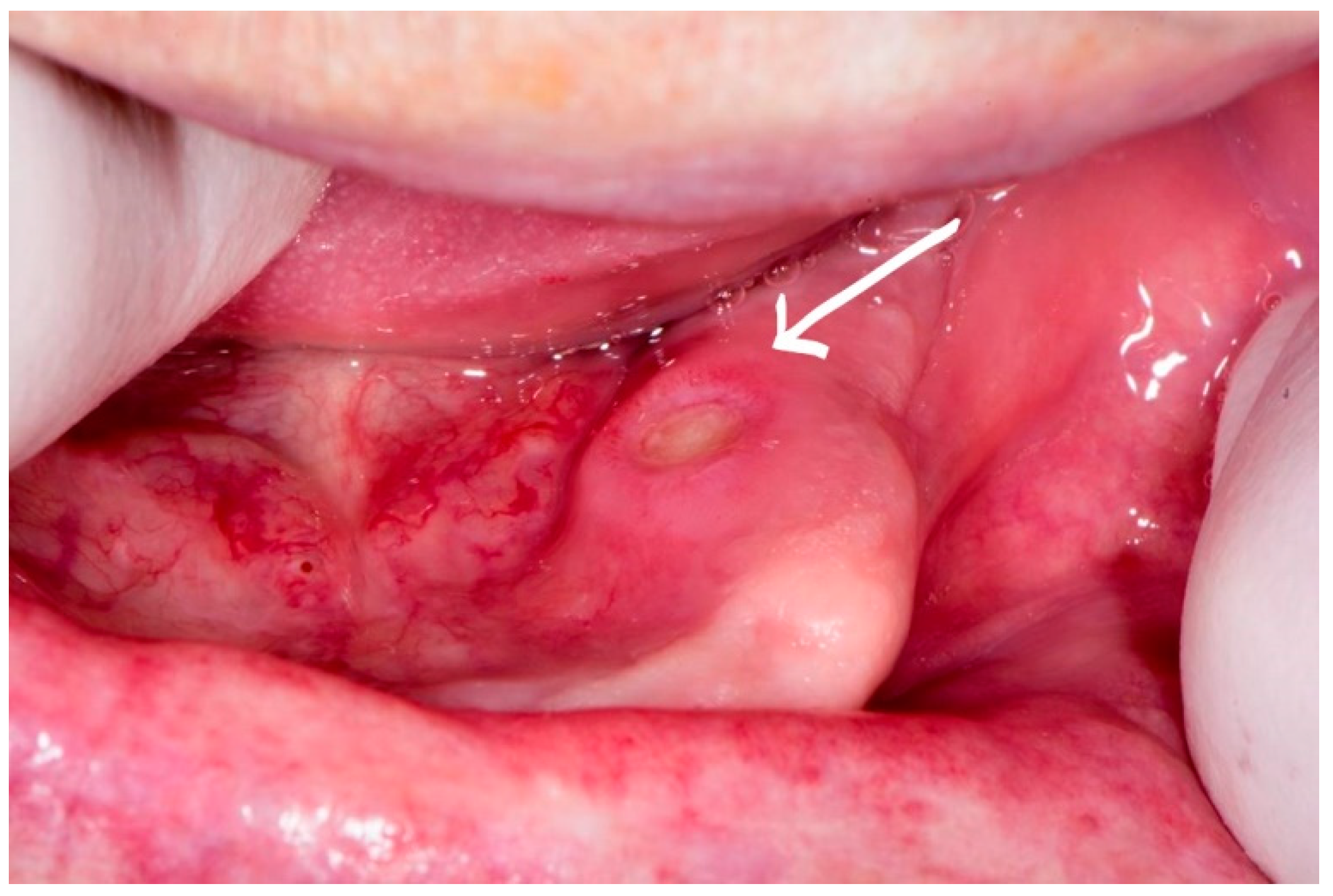 Dentistry 07 00055 g004