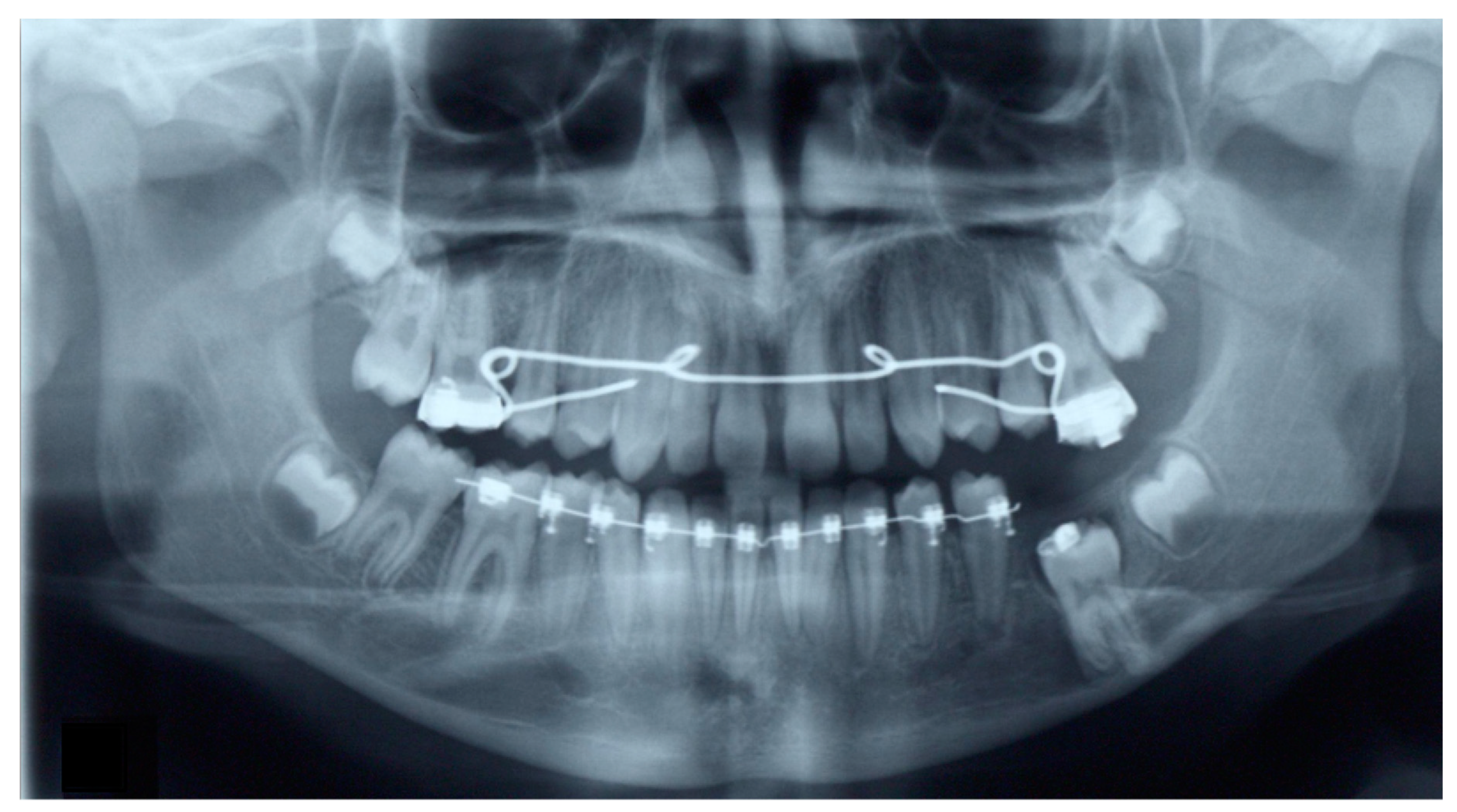 Dentistry 07 00063 g004