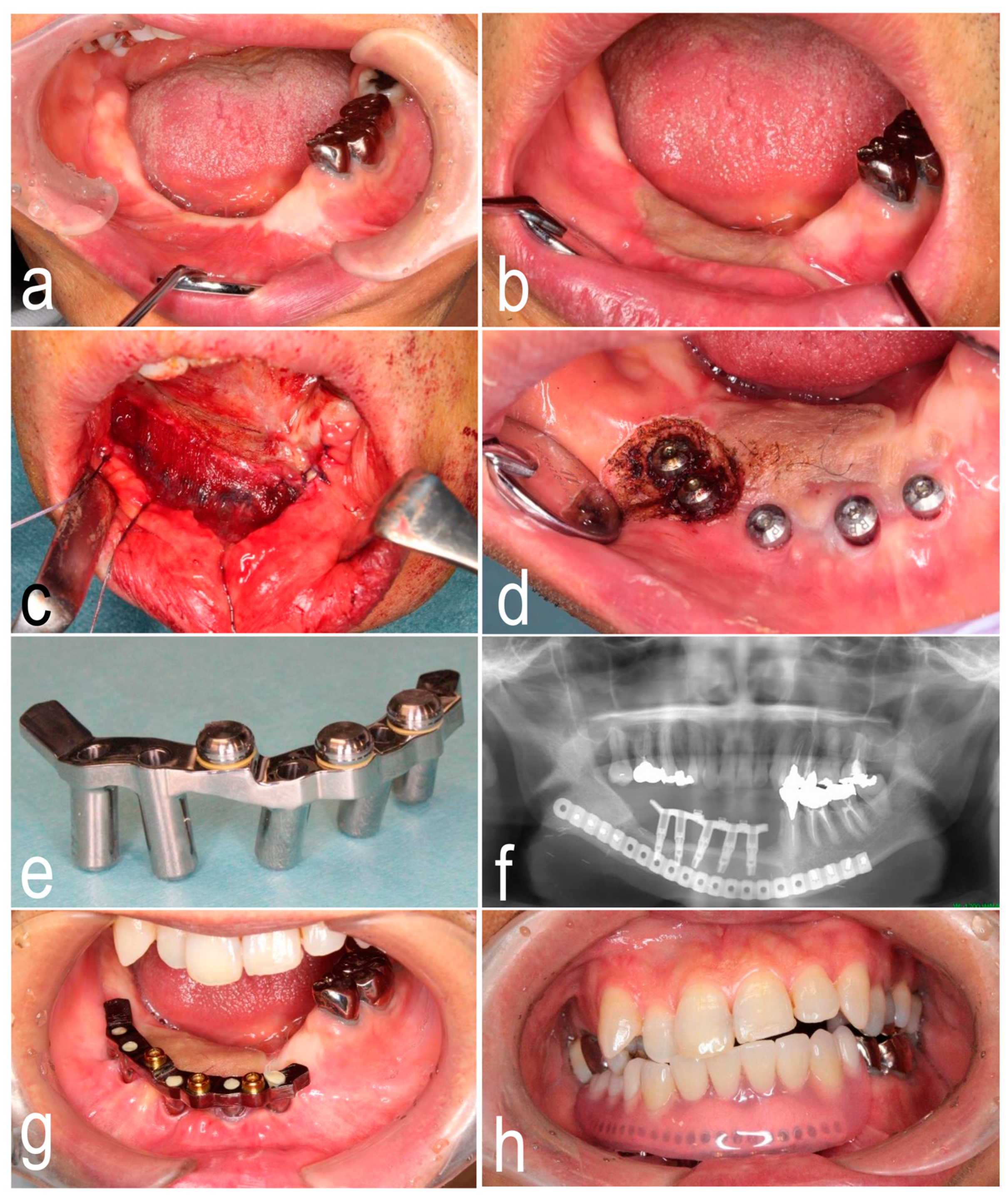 Dentistry 07 00065 g001