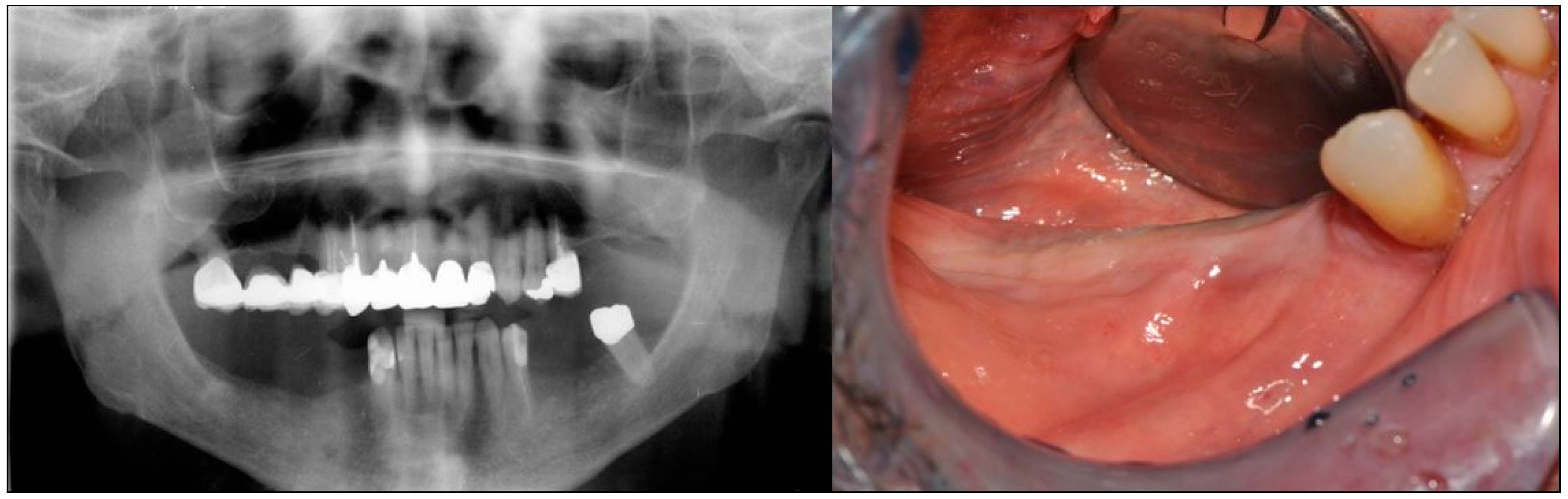 Dentistry 07 00077 g001 Dentistry 07 00077 g001