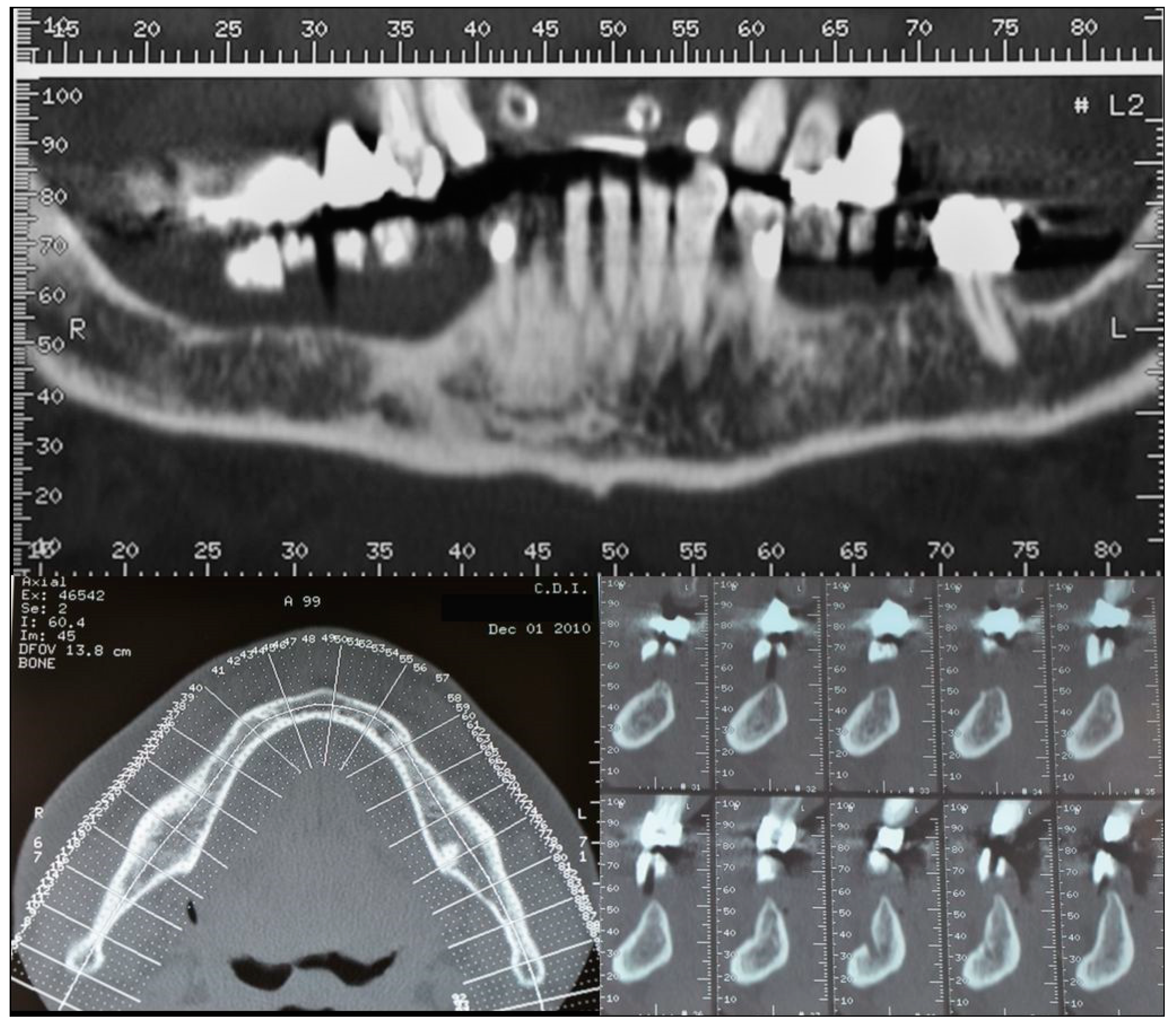 Dentistry 07 00077 g002 Dentistry 07 00077 g002
