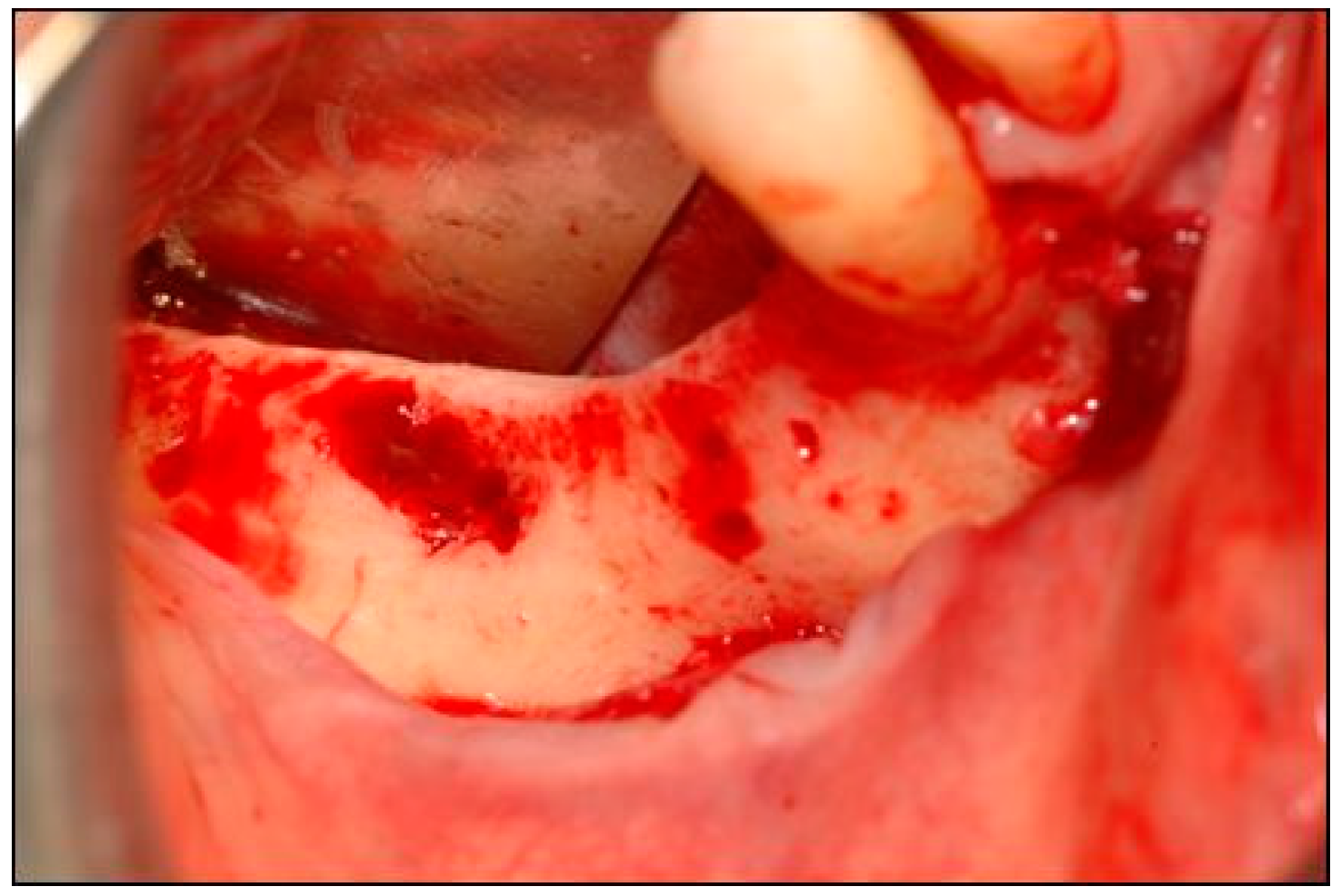 Dentistry 07 00077 g004 Dentistry 07 00077 g004