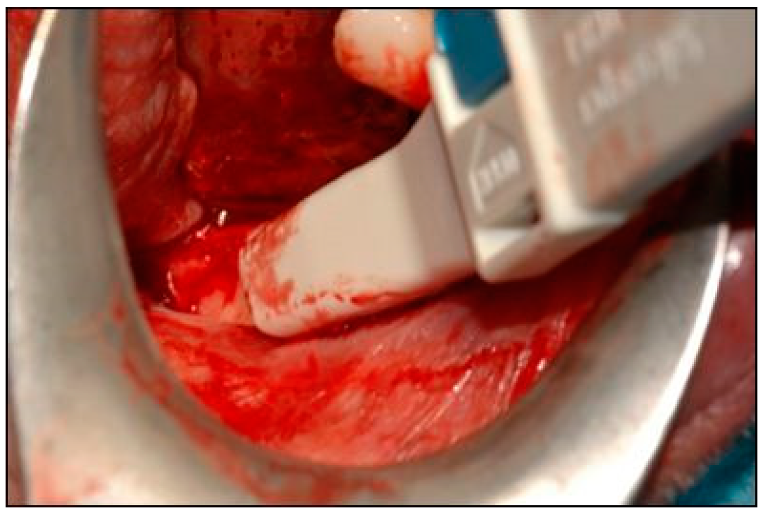 Dentistry 07 00077 g005 Dentistry 07 00077 g005