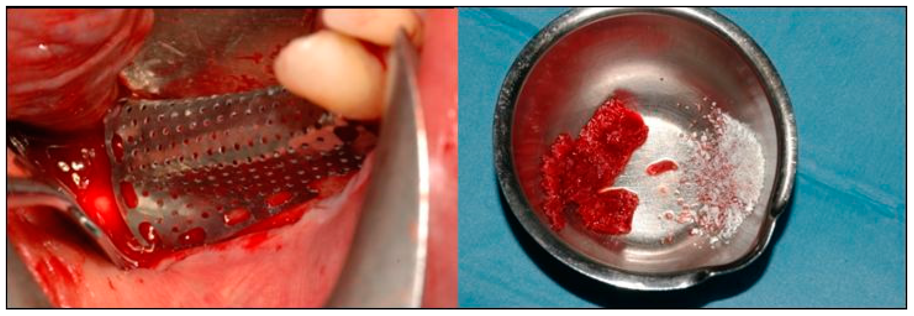 Dentistry 07 00077 g006 Dentistry 07 00077 g006