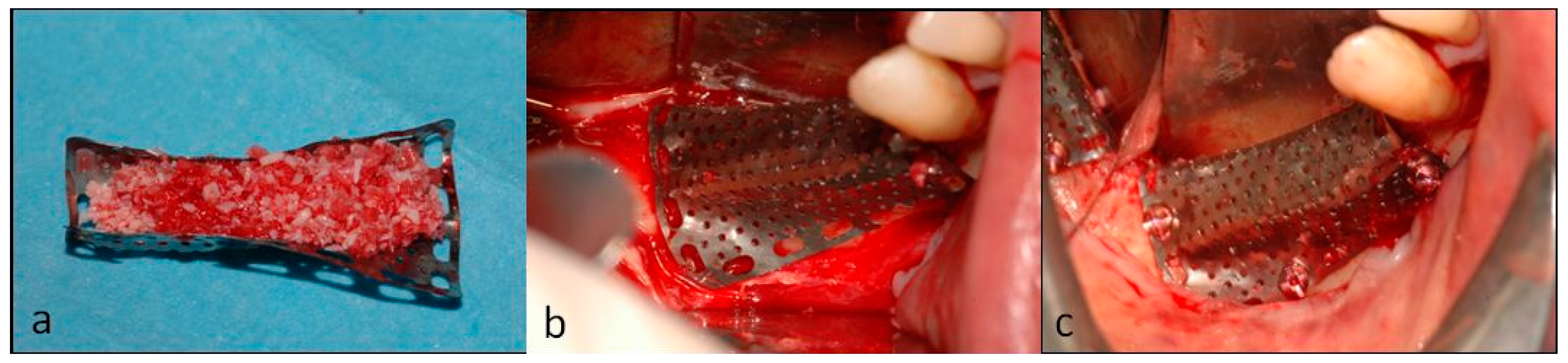 Dentistry 07 00077 g007 Dentistry 07 00077 g007