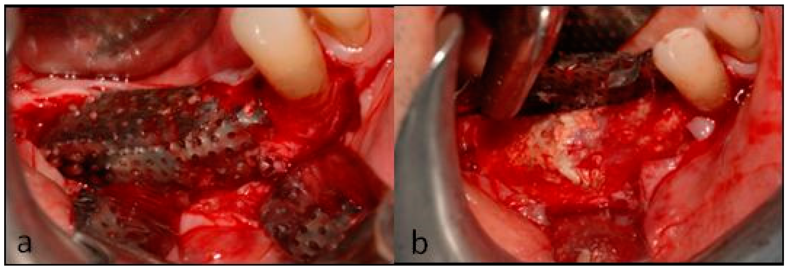 Dentistry 07 00077 g009 Dentistry 07 00077 g009