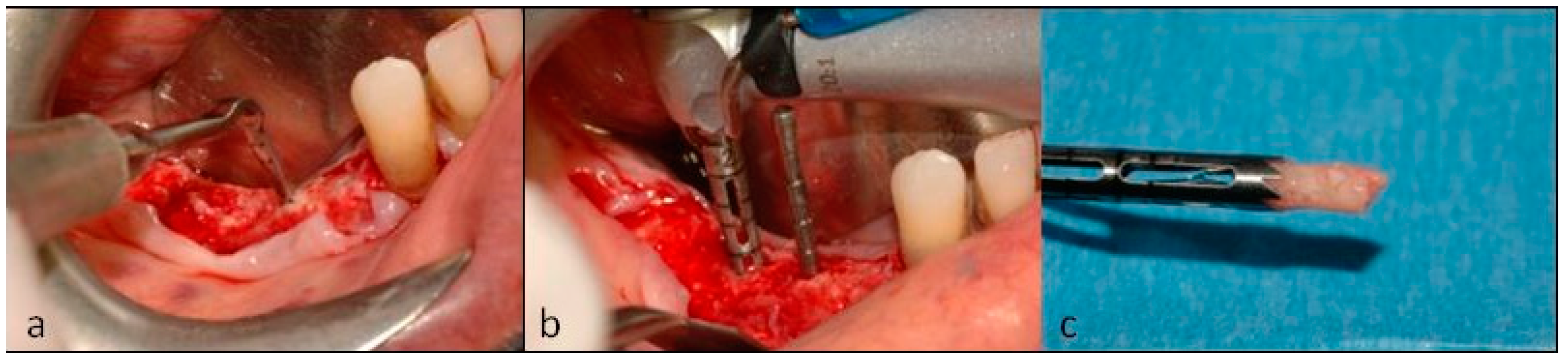 Dentistry 07 00077 g010 Dentistry 07 00077 g010