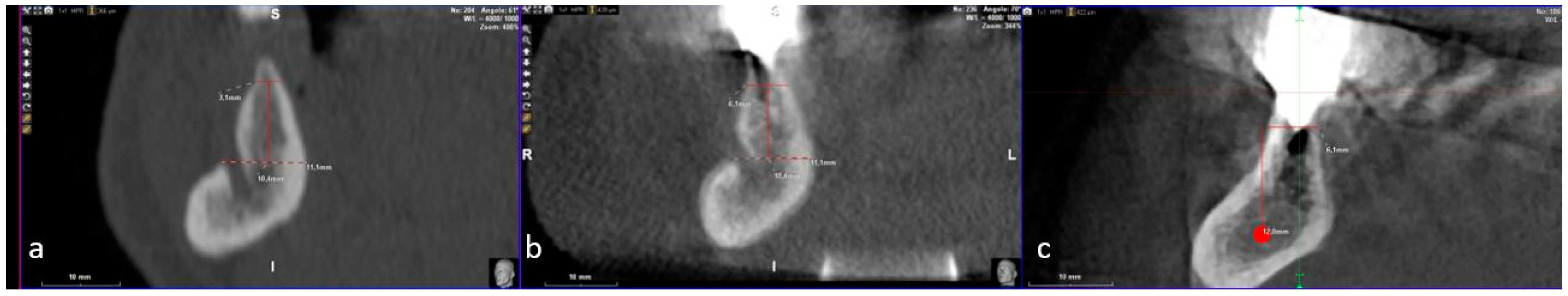 Dentistry 07 00077 g013 Dentistry 07 00077 g013