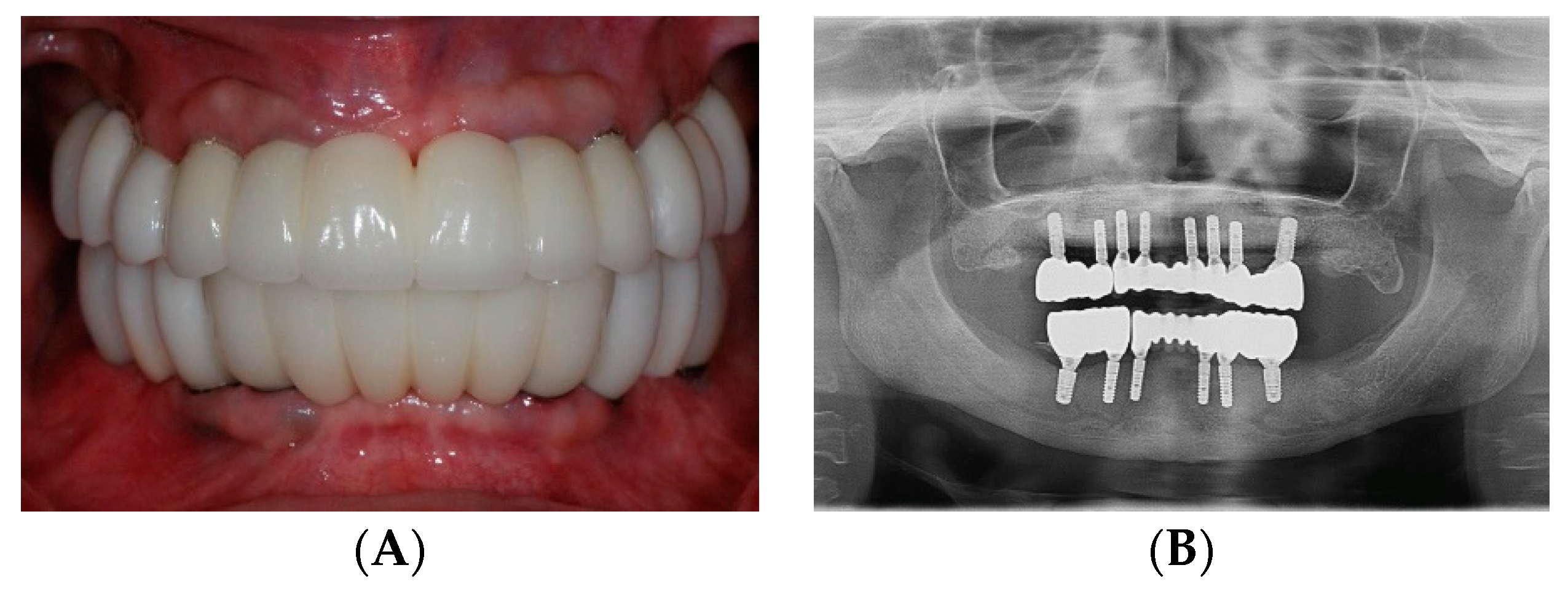 Dentistry 07 00100 g008