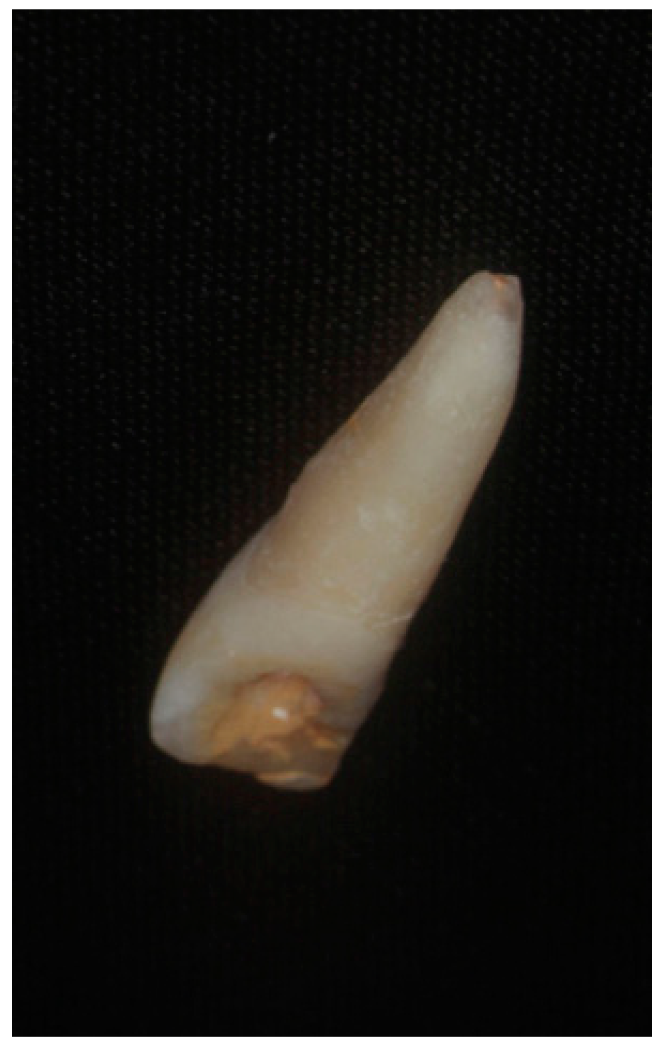 Dentistry 07 00101 g002 Dentistry 07 00101 g002