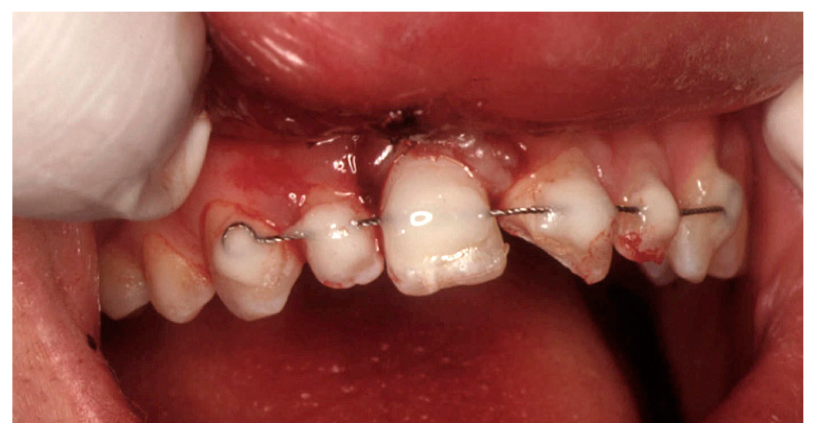 Dentistry 07 00101 g003 Dentistry 07 00101 g003