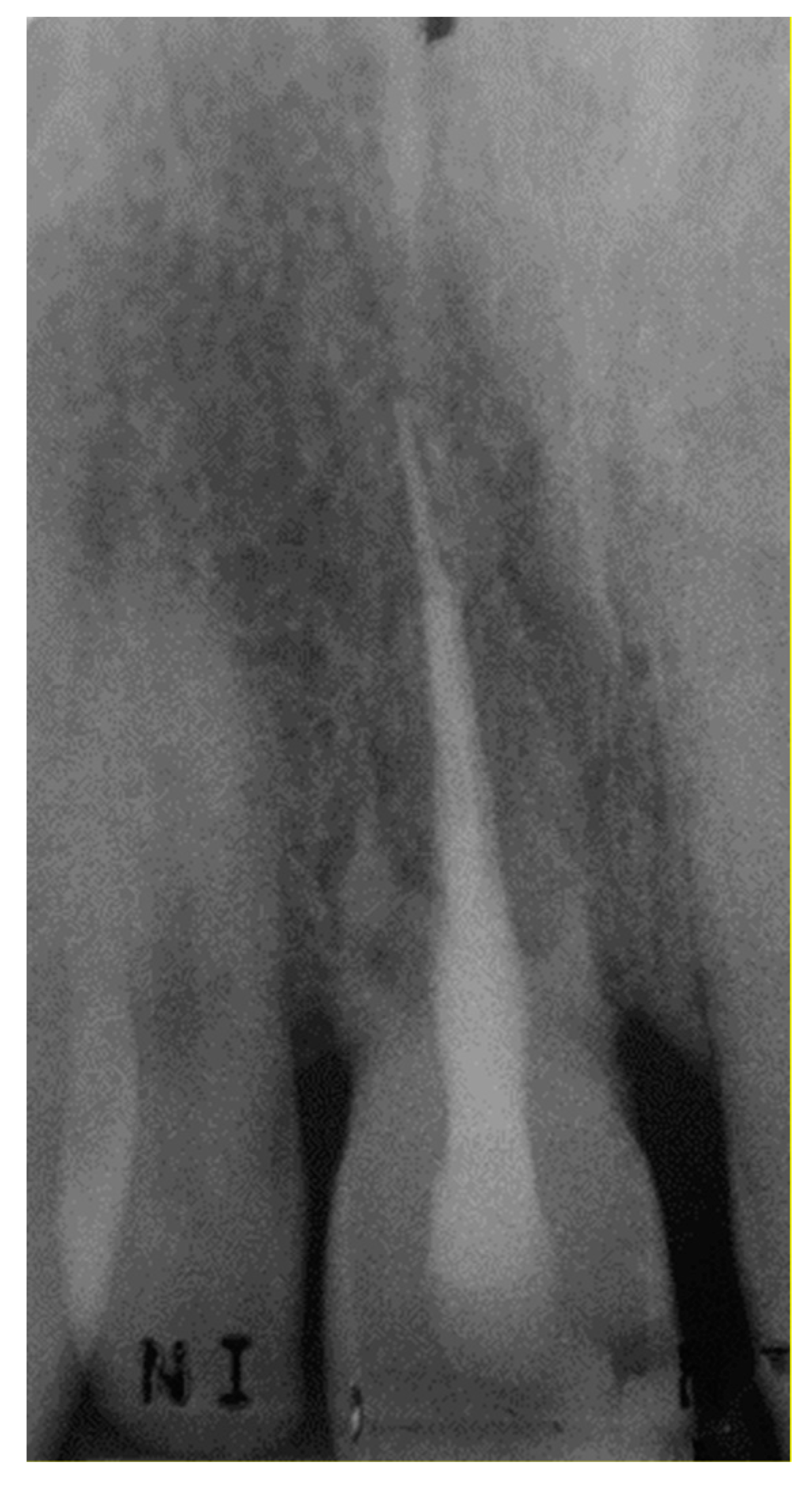 Dentistry 07 00101 g009 Dentistry 07 00101 g009