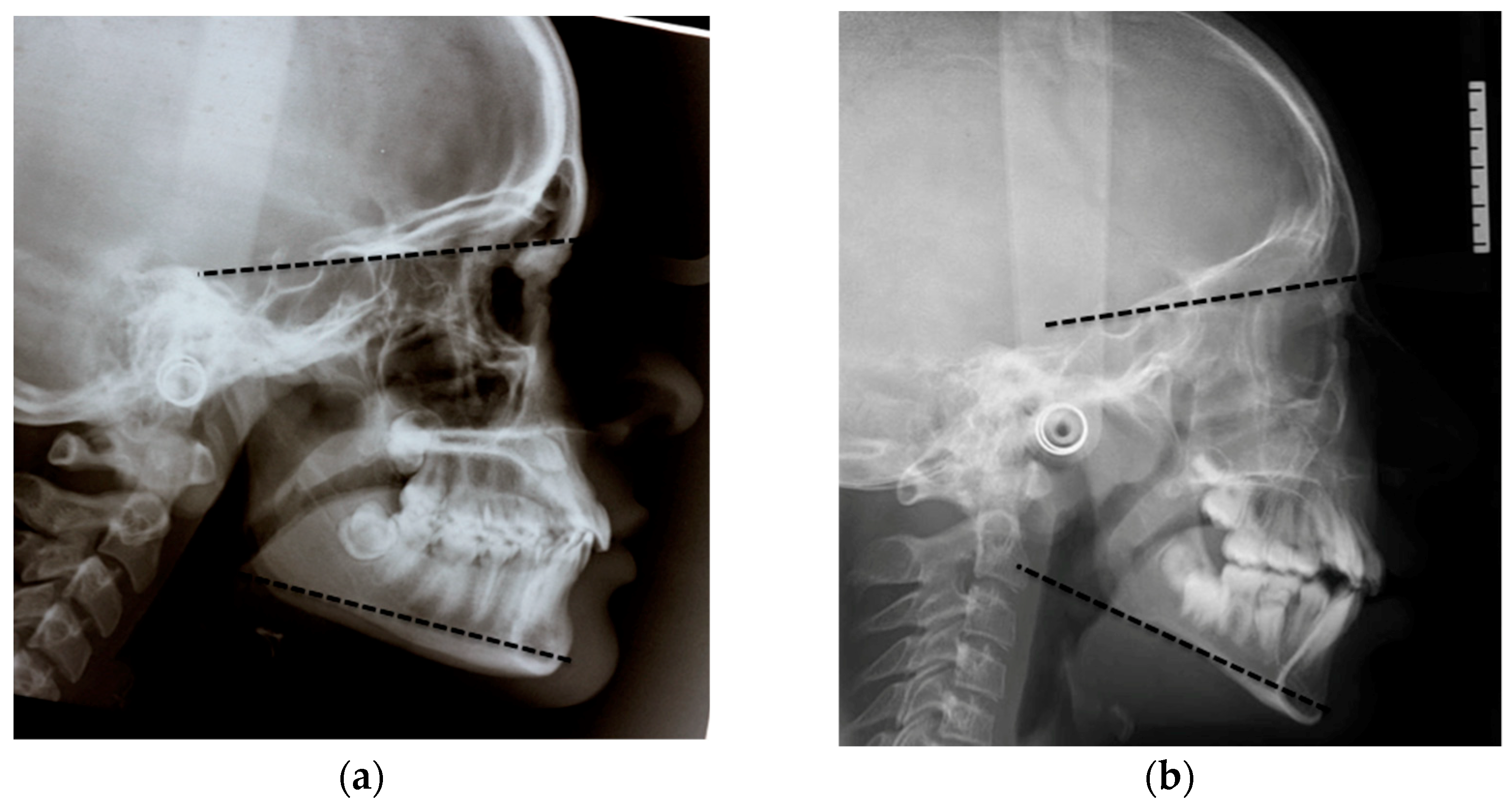 Dentistry 07 00104 g002a