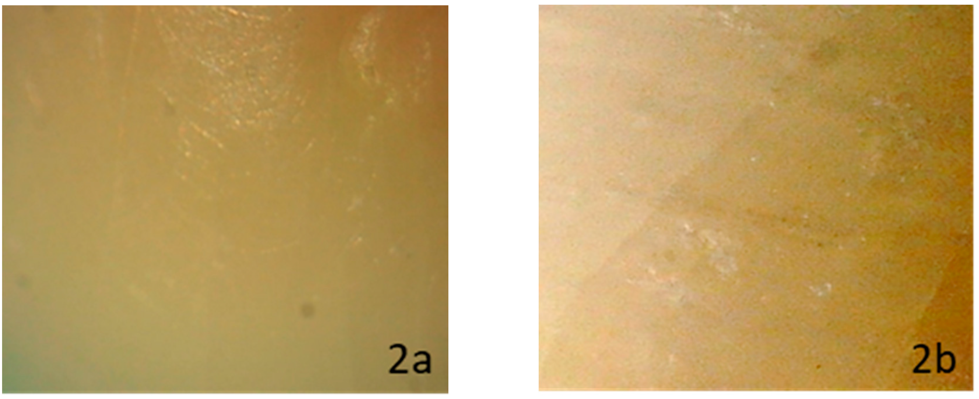 Dentistry 08 00006 g002 Dentistry 08 00006 g002