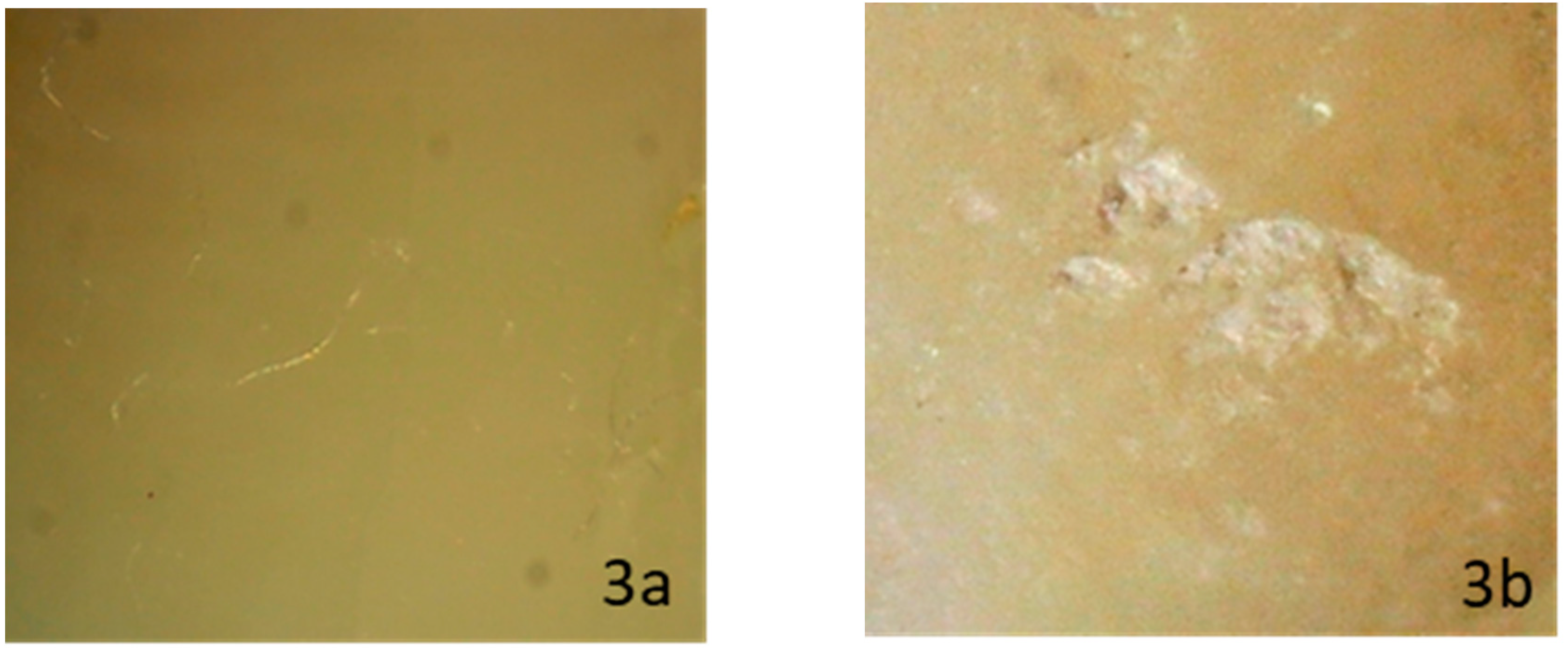 Dentistry 08 00006 g003 Dentistry 08 00006 g003