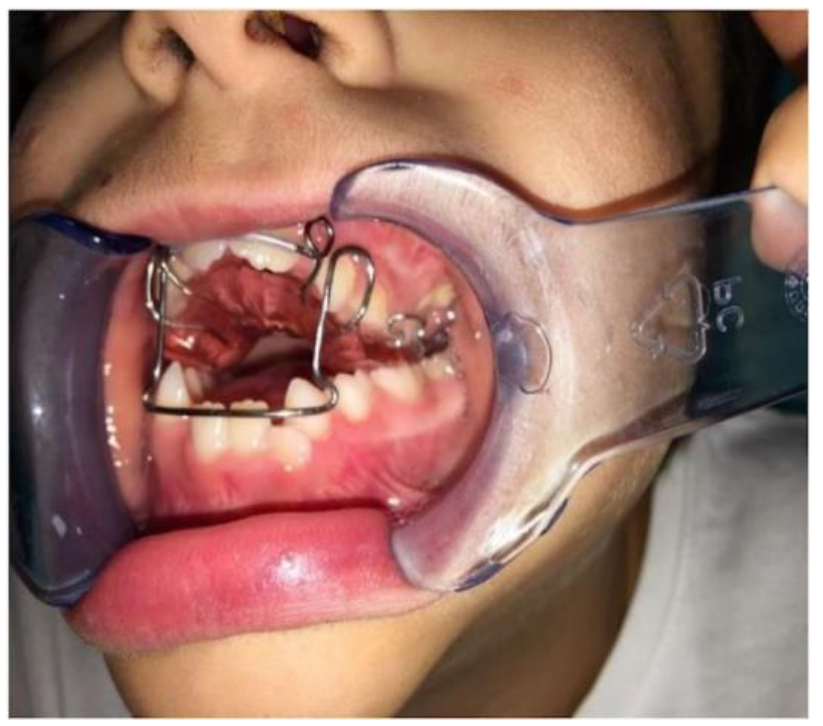 Dentistry 08 00012 g001