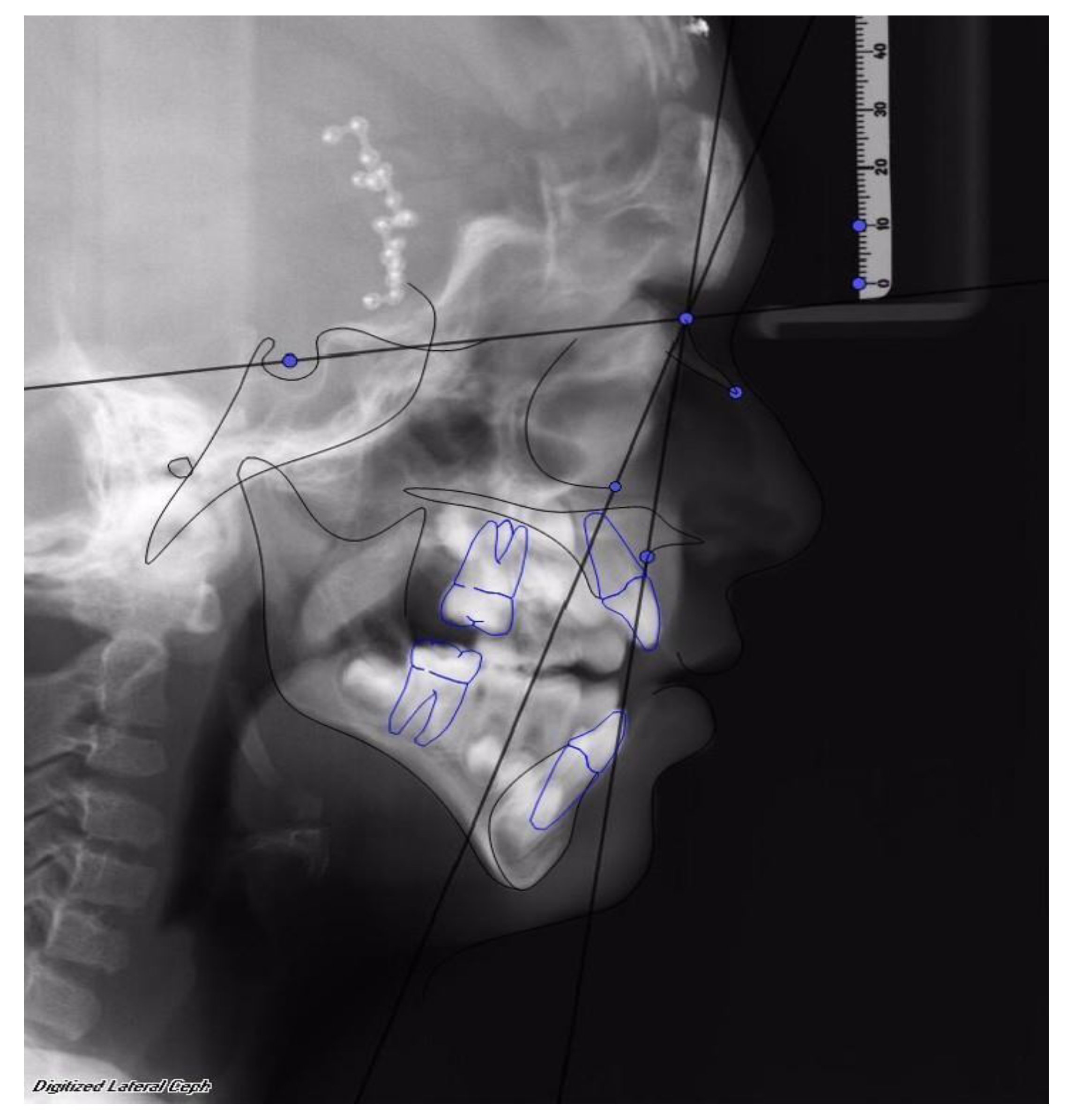 Dentistry 08 00012 g002