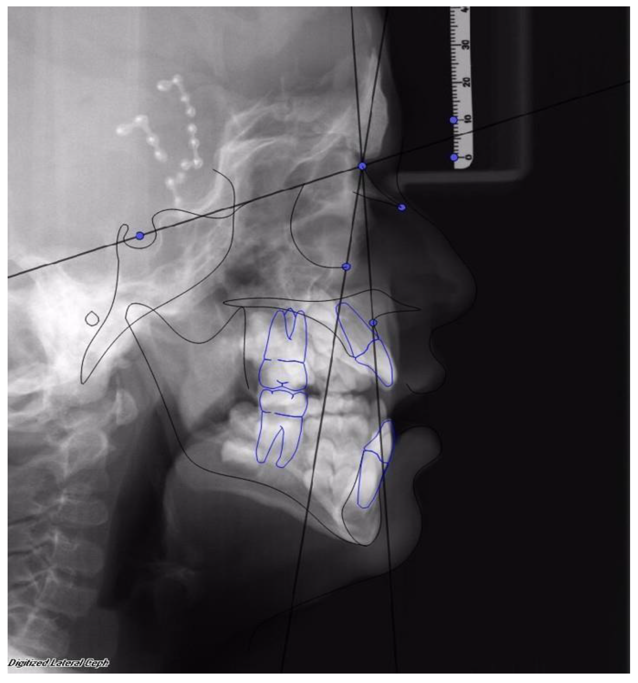 Dentistry 08 00012 g003