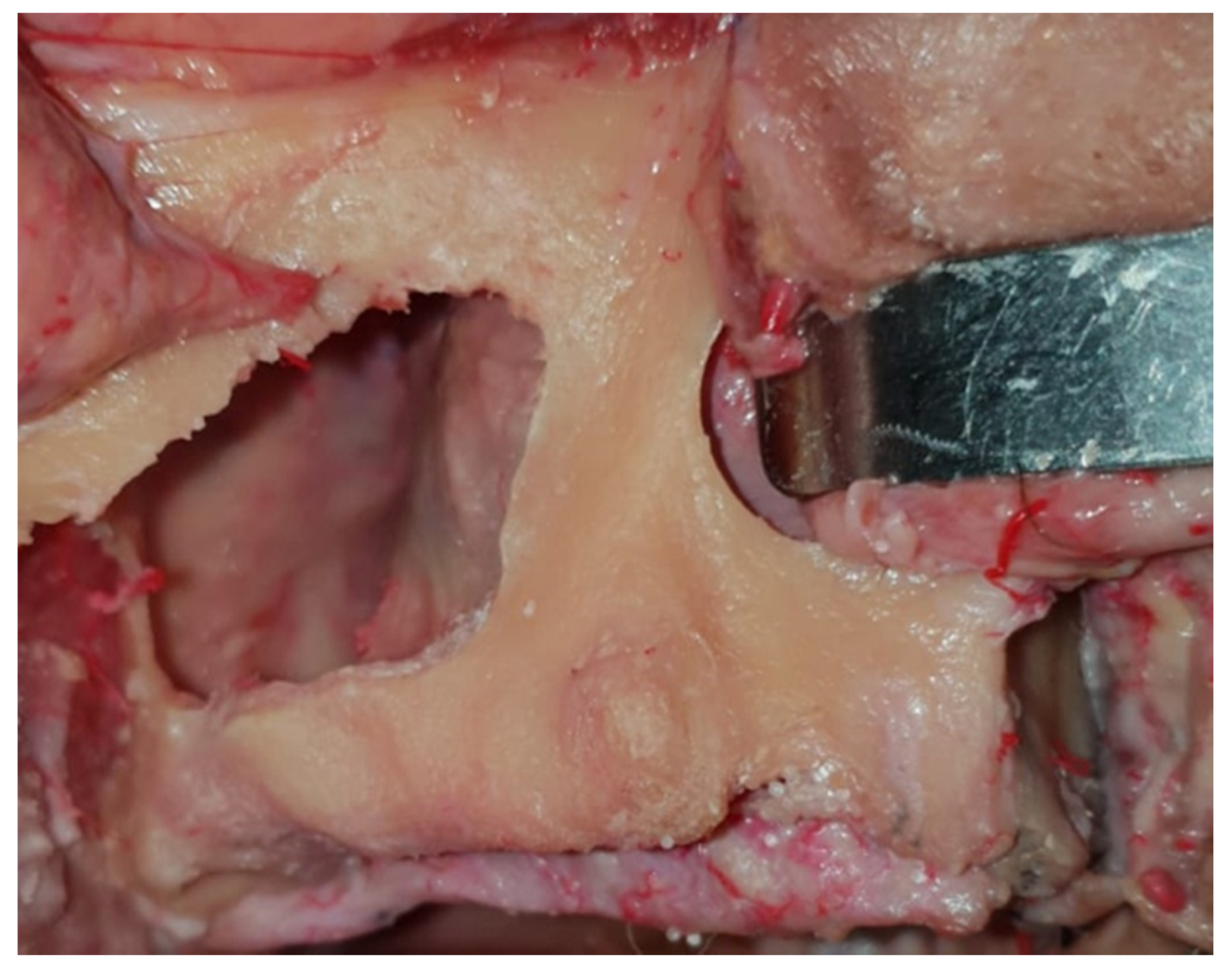 Dentistry 08 00014 g001 Dentistry 08 00014 g001