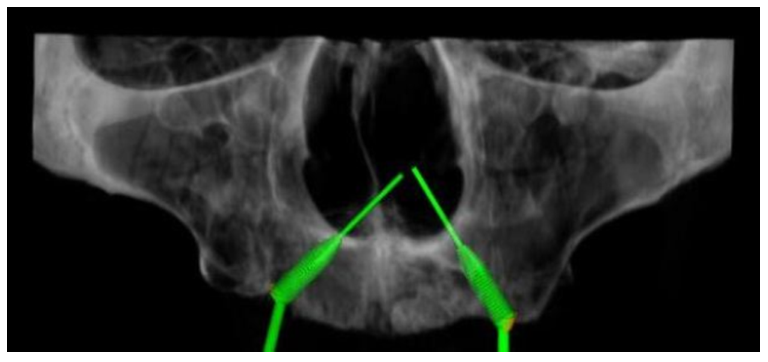 Dentistry 08 00014 g003 Dentistry 08 00014 g003