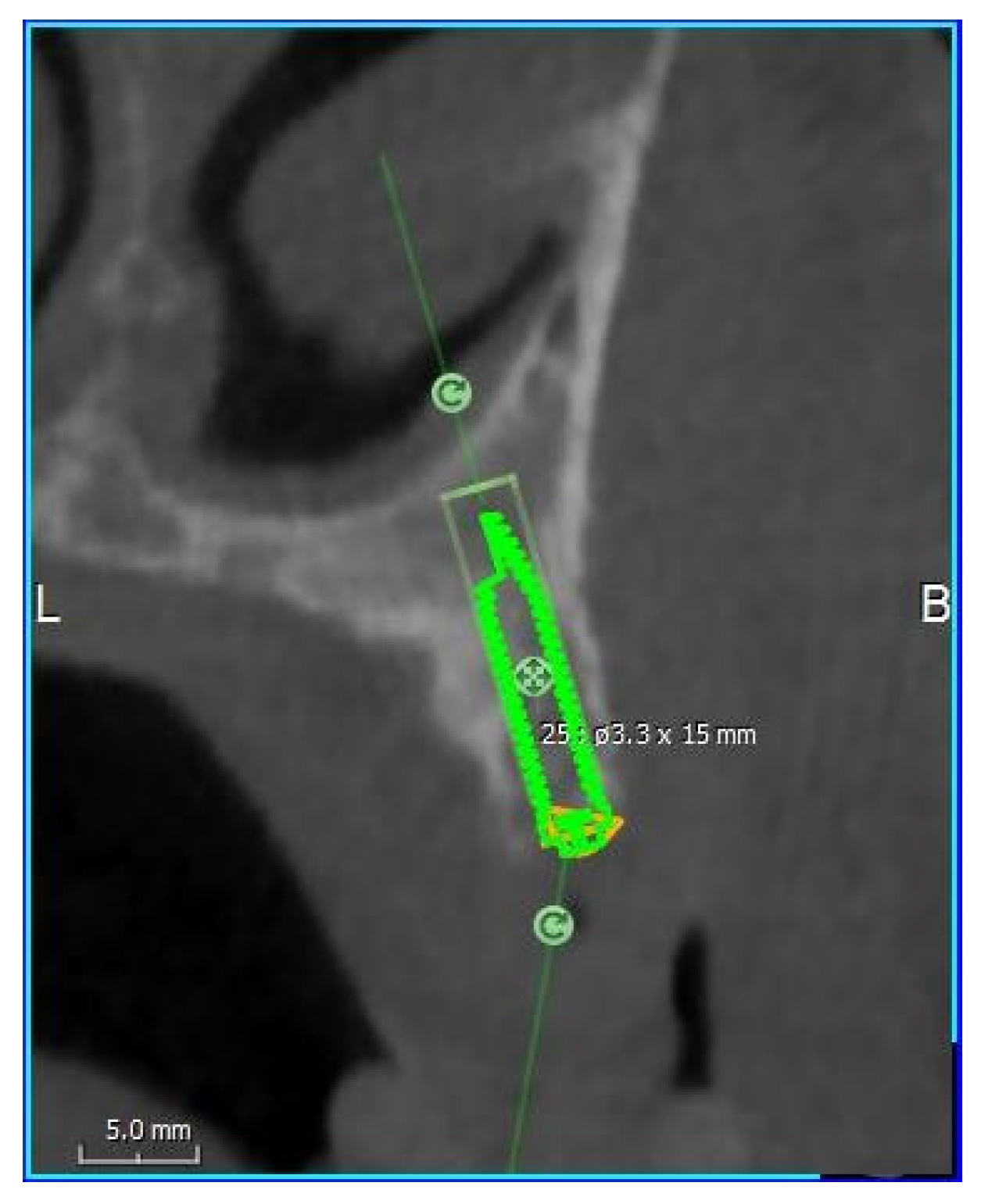 Dentistry 08 00014 g004 Dentistry 08 00014 g004