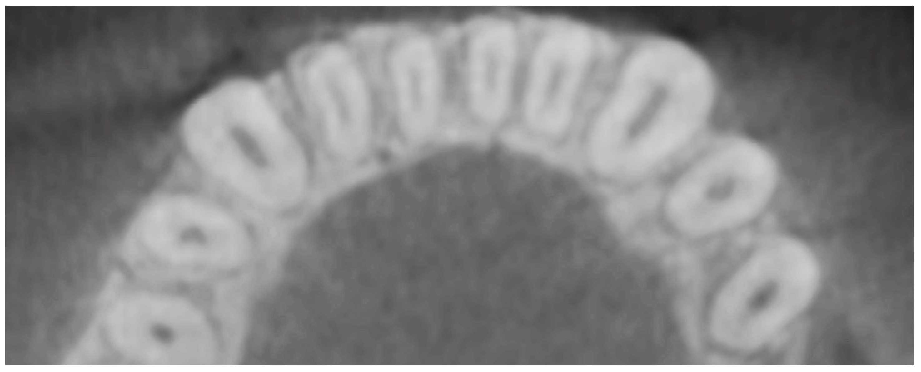 Dentistry 08 00019 g001 Dentistry 08 00019 g001