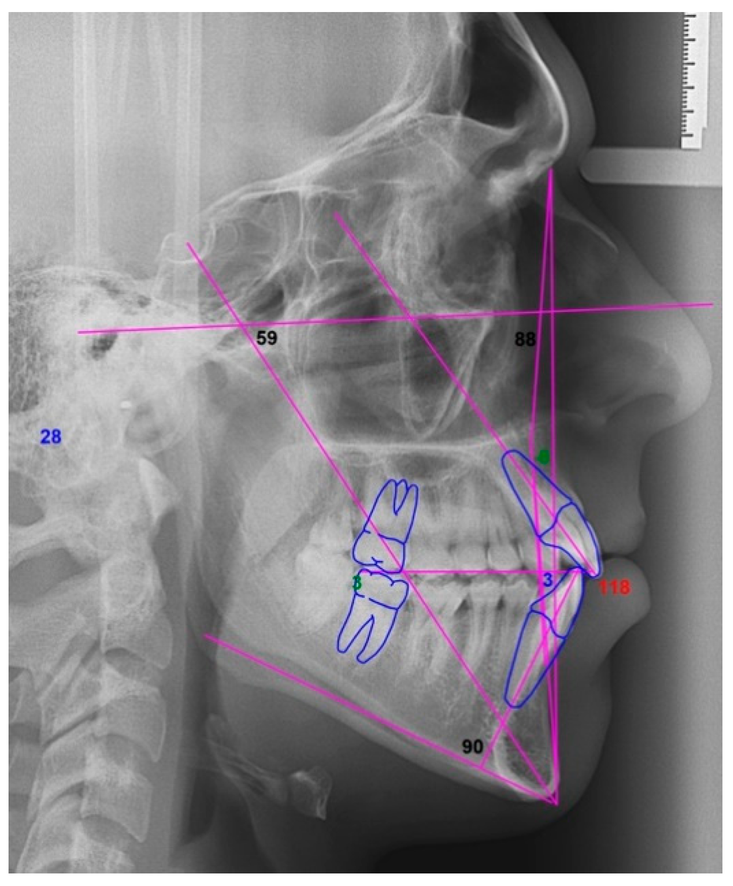 Dentistry 08 00019 g006 Dentistry 08 00019 g006