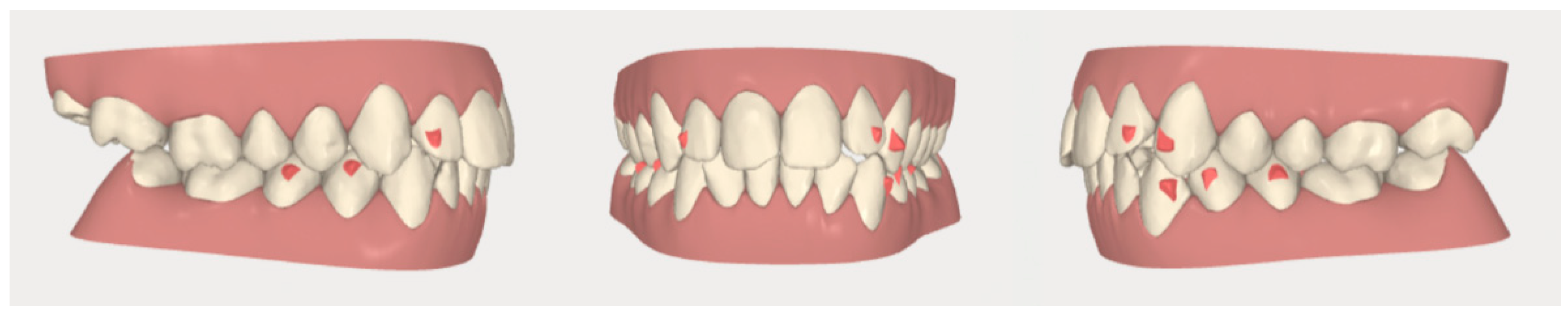 Dentistry 08 00019 g007 Dentistry 08 00019 g007