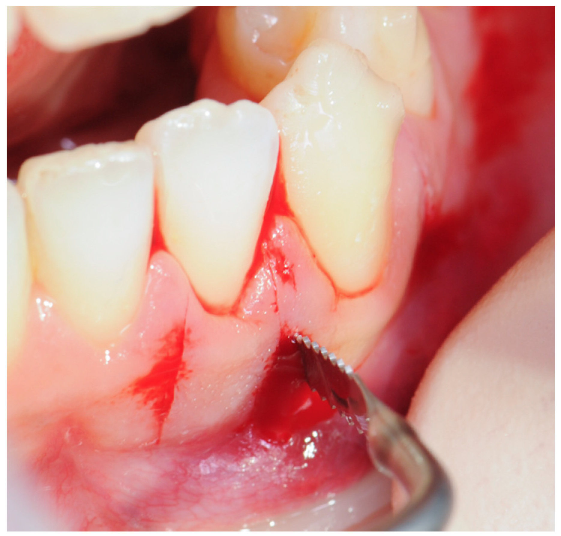 Dentistry 08 00019 g008 Dentistry 08 00019 g008