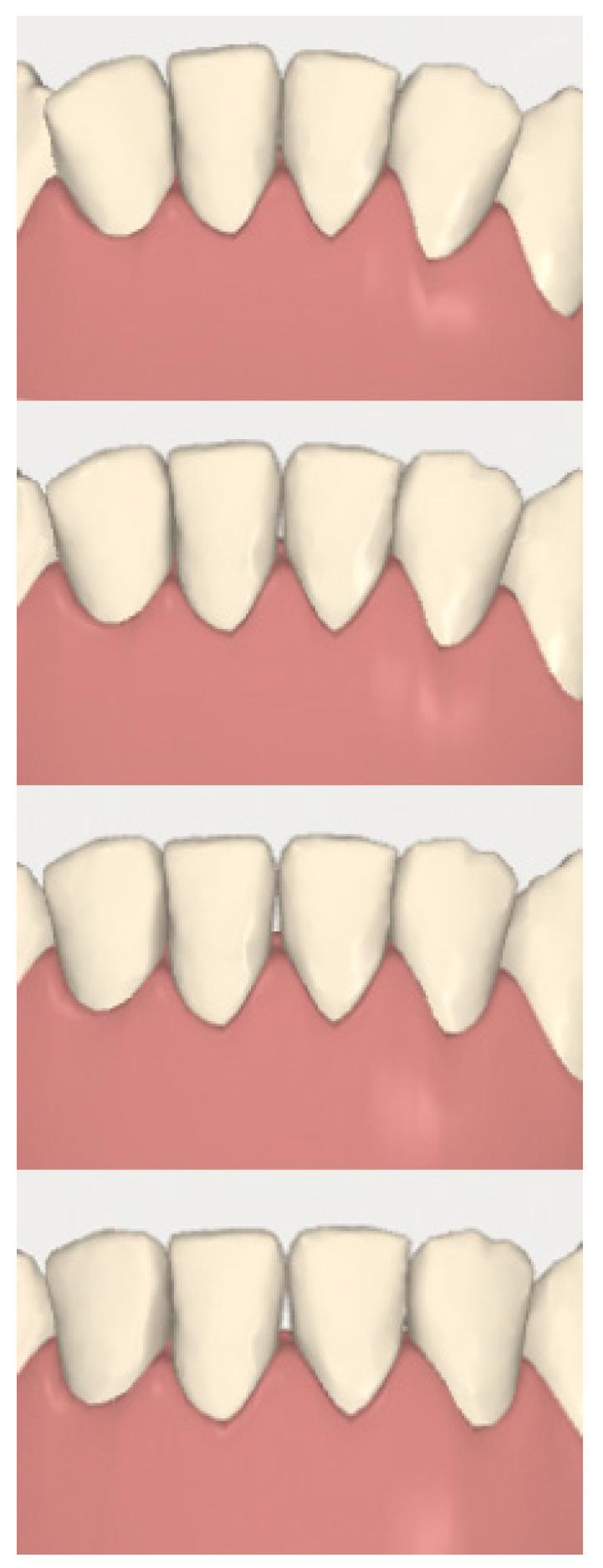 Dentistry 08 00019 g010 Dentistry 08 00019 g010