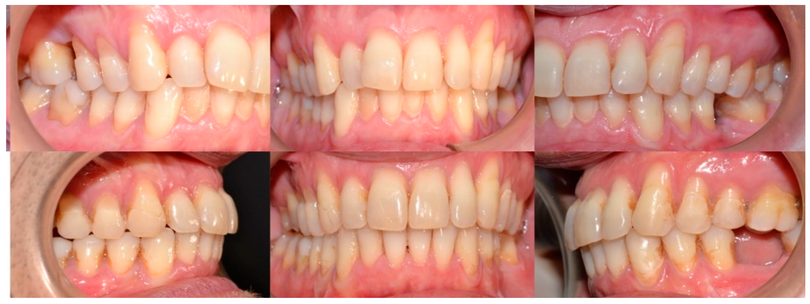 Dentistry 08 00019 g011 Dentistry 08 00019 g011