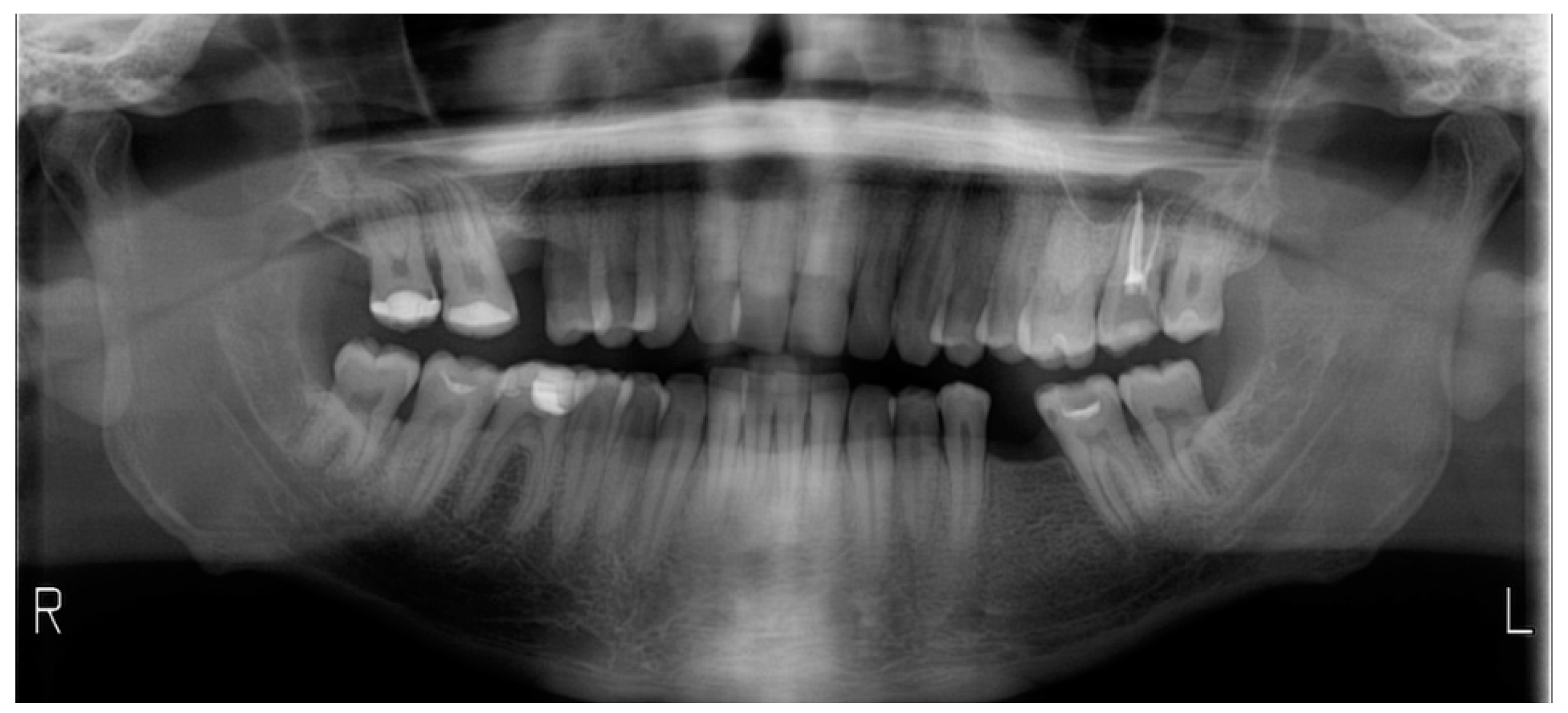 Dentistry 08 00019 g013 Dentistry 08 00019 g013