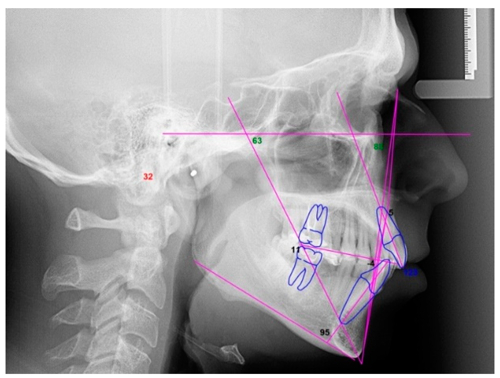 Dentistry 08 00019 g014 Dentistry 08 00019 g014