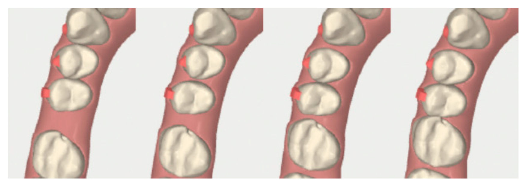 Dentistry 08 00019 g016 Dentistry 08 00019 g016