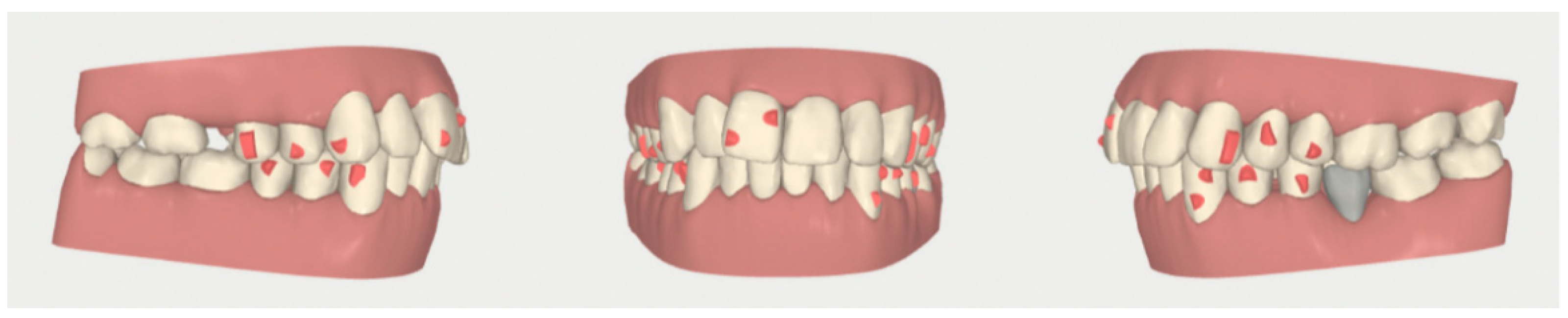 Dentistry 08 00019 g018 Dentistry 08 00019 g018