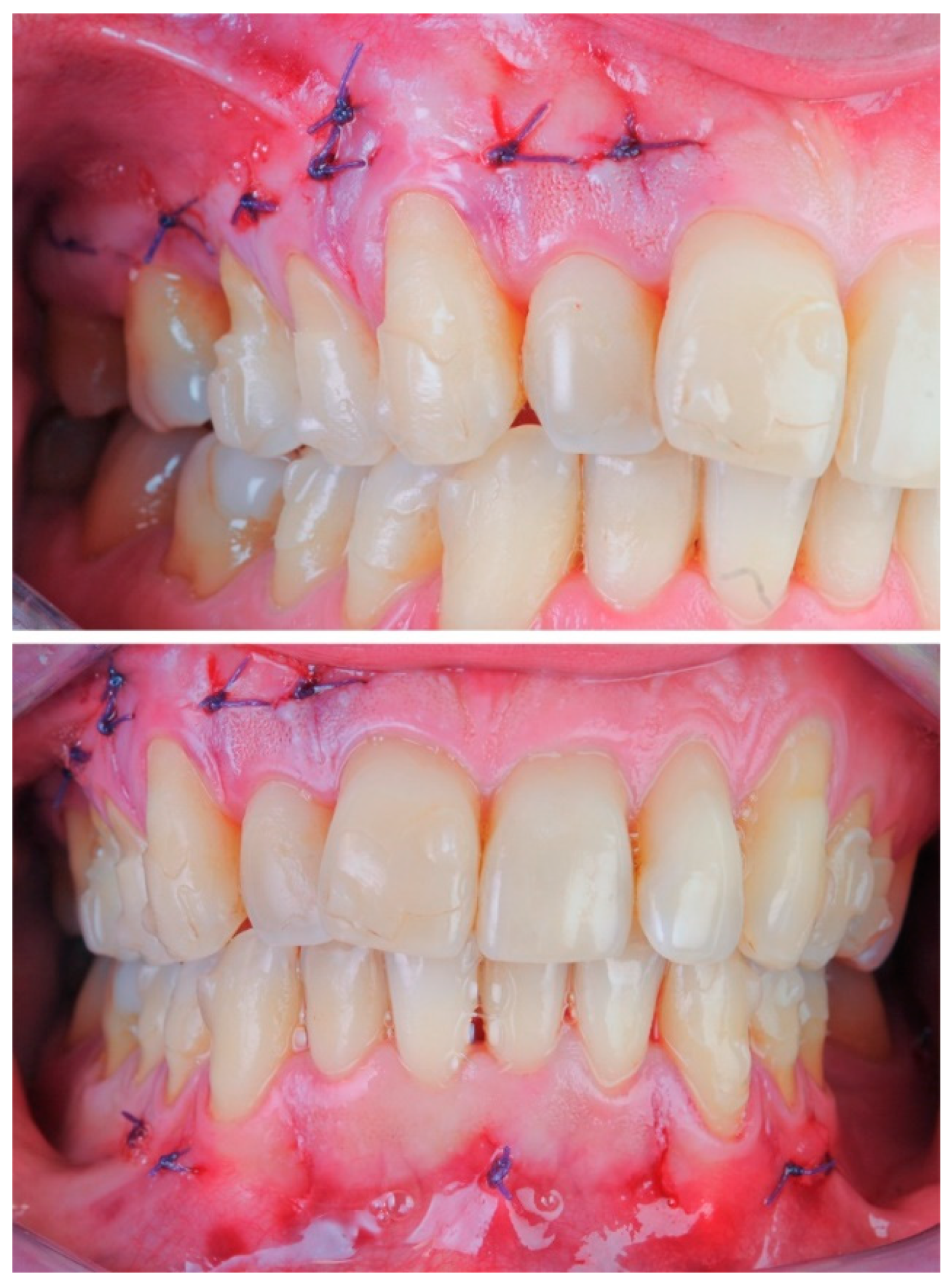 Dentistry 08 00019 g019 Dentistry 08 00019 g019