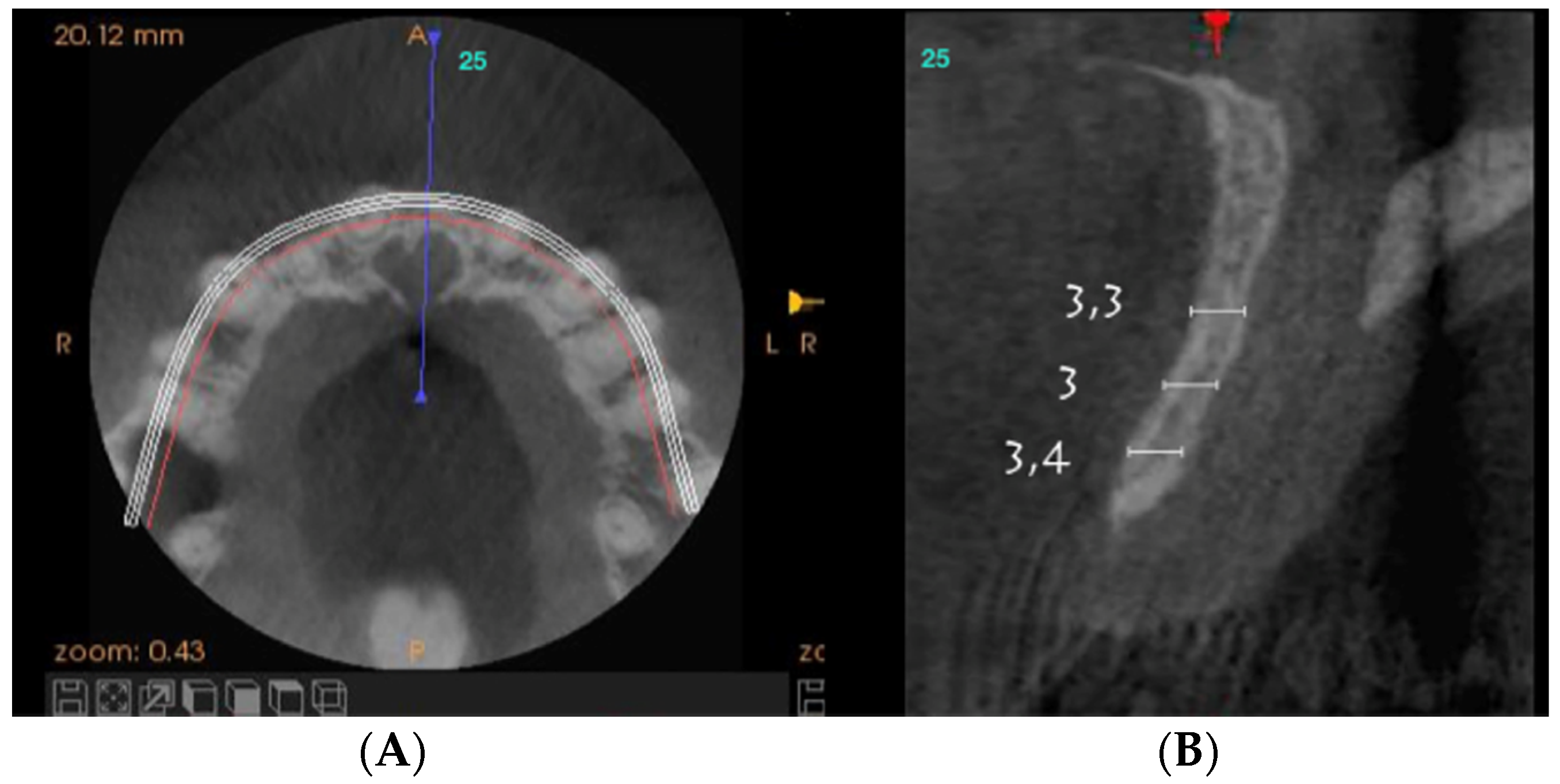 Dentistry 08 00030 g002