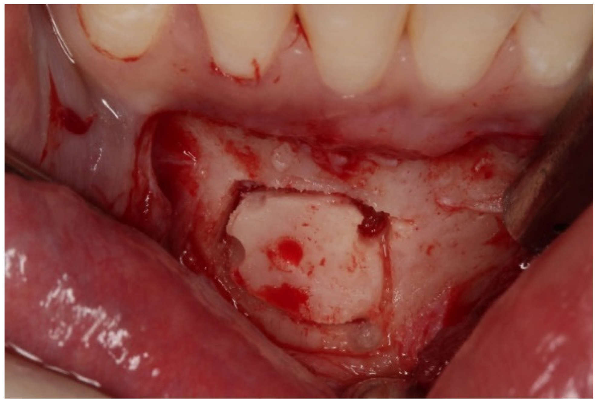 Dentistry 08 00030 g003