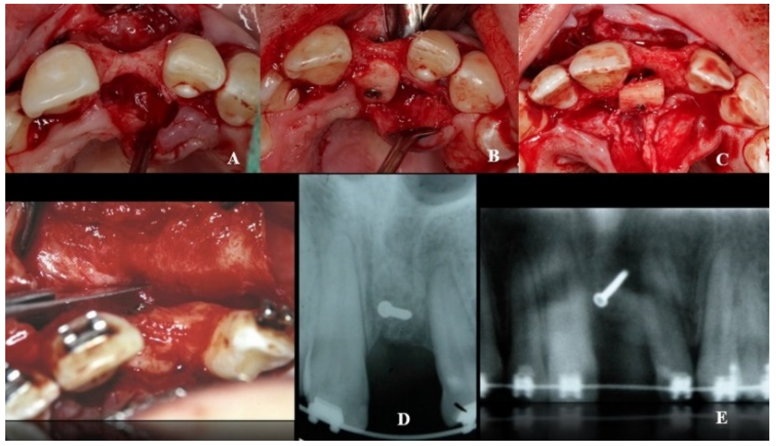 Dentistry 08 00030 g004