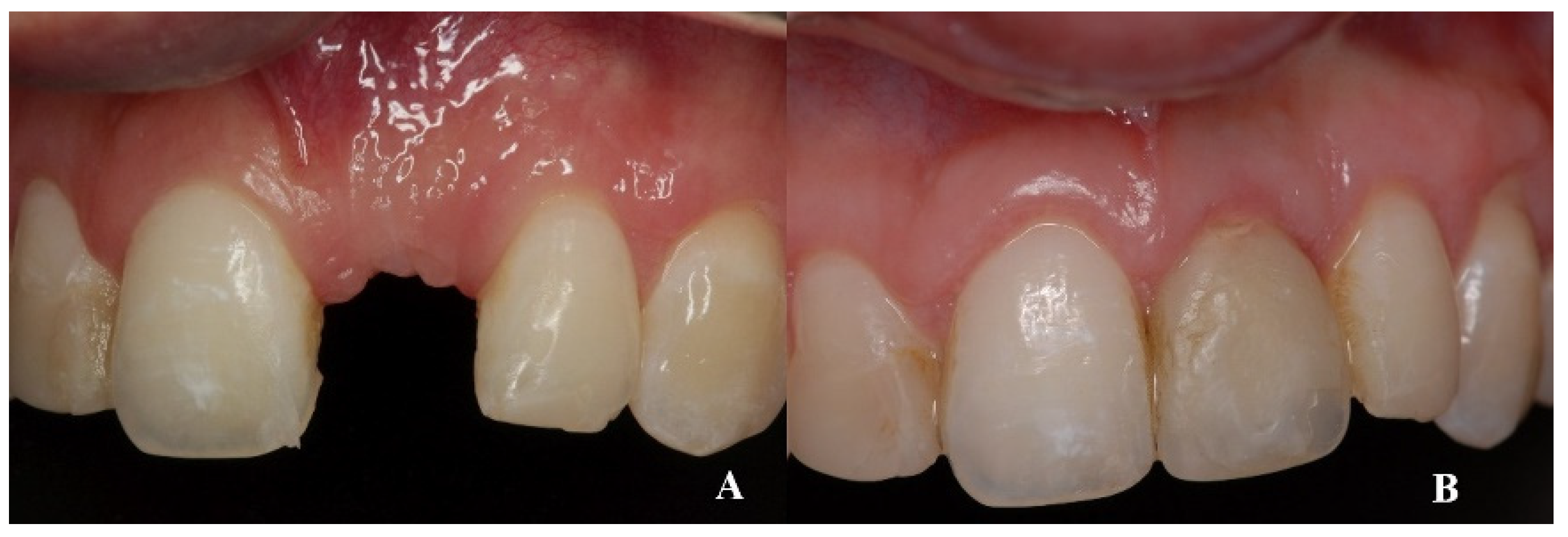 Dentistry 08 00030 g006