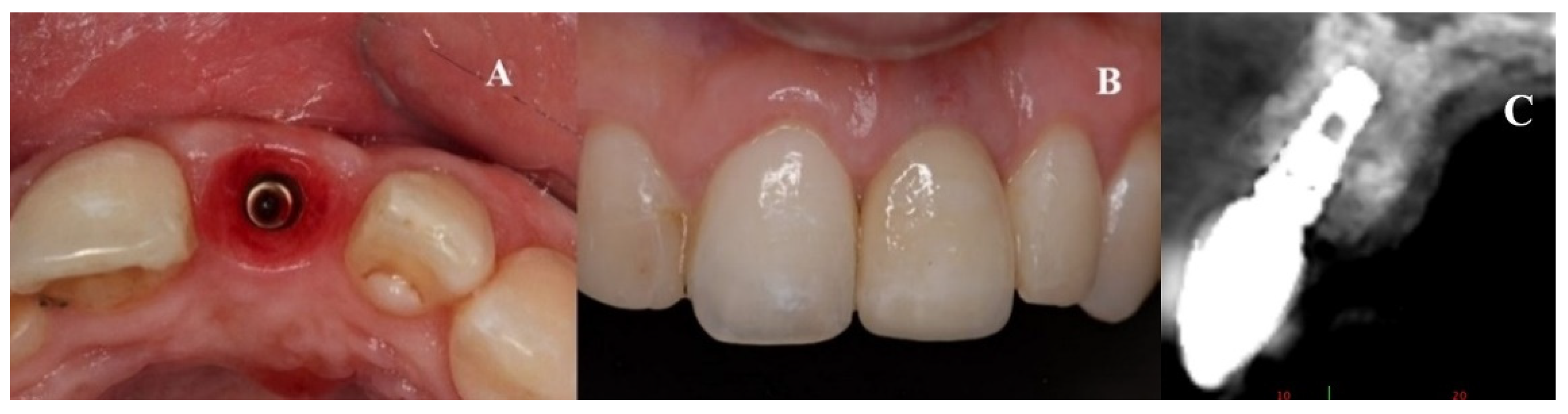 Dentistry 08 00030 g009