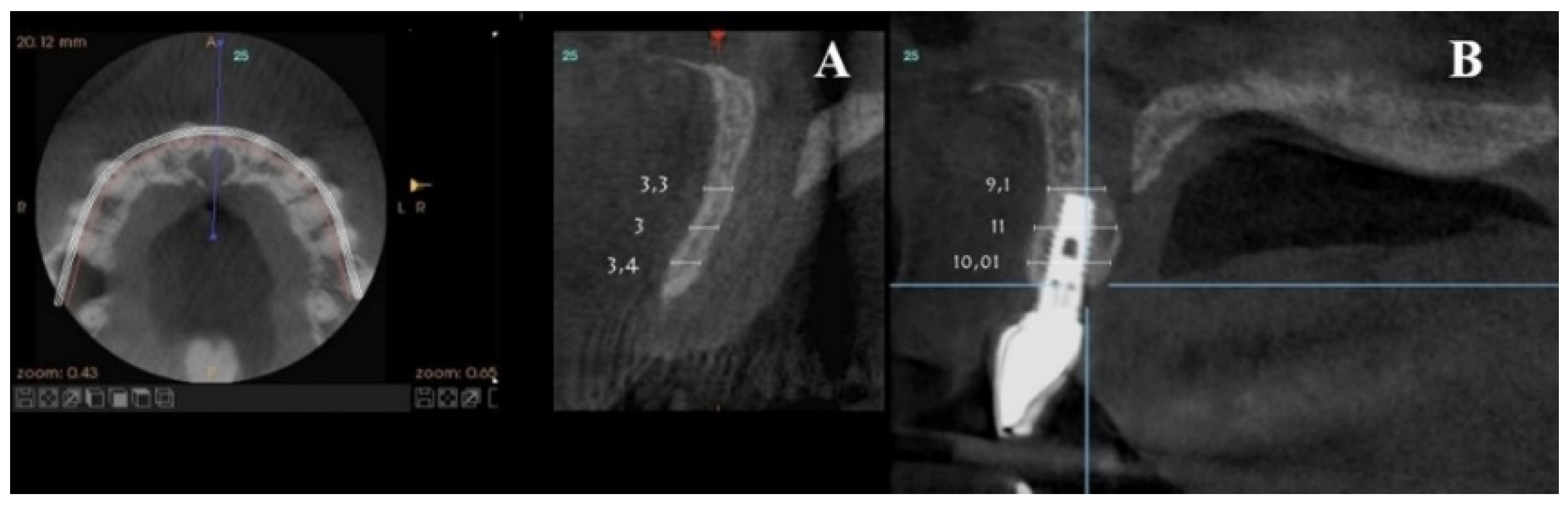 Dentistry 08 00030 g010