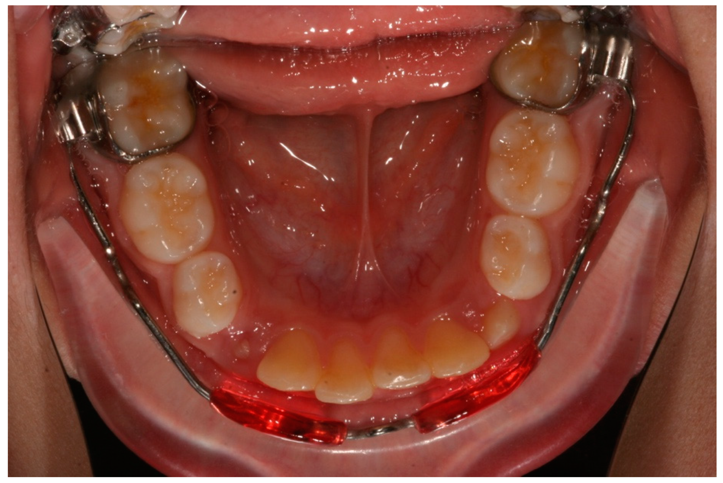 Dentistry 08 00034 g001 Dentistry 08 00034 g001