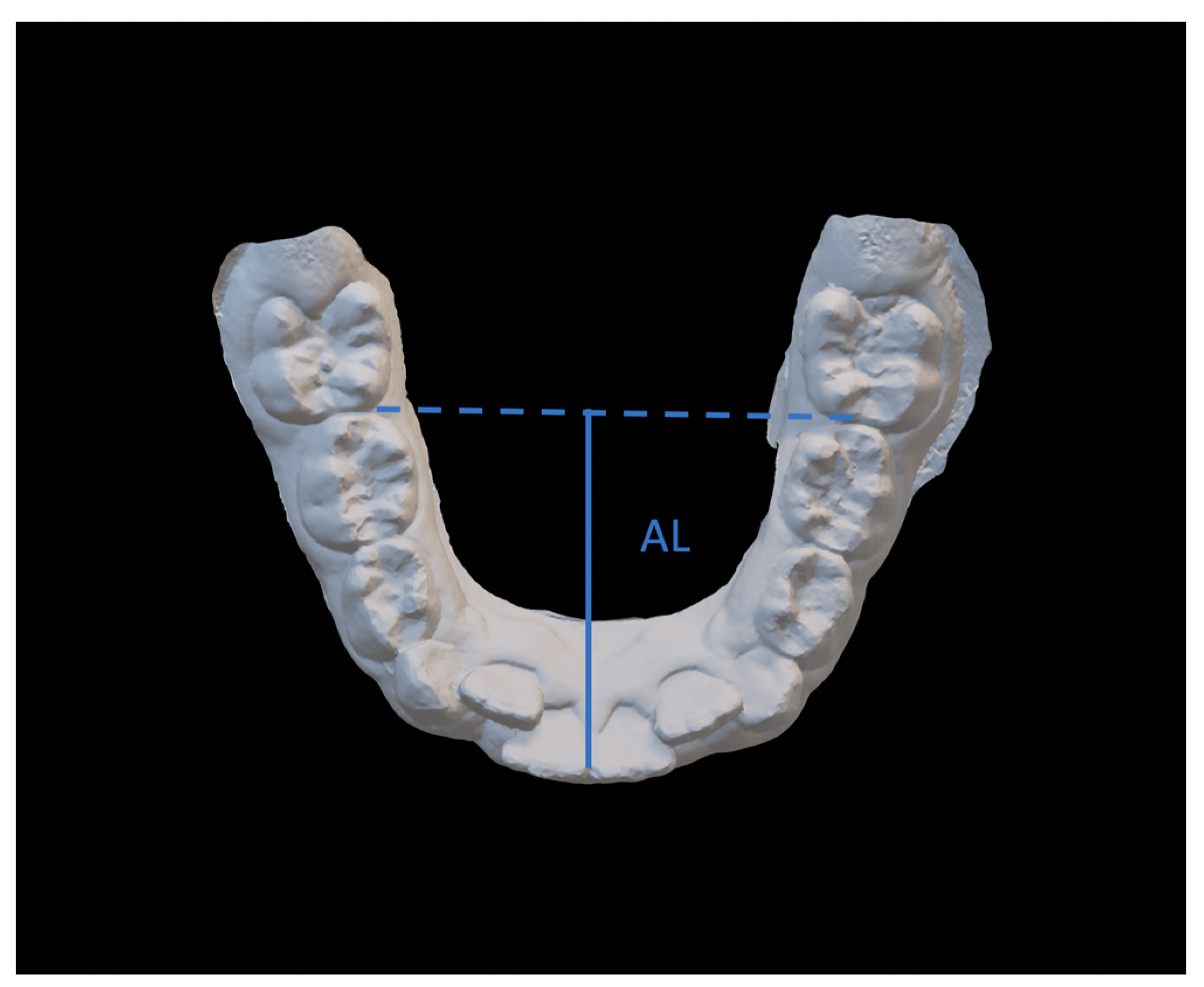 Dentistry 08 00034 g004 Dentistry 08 00034 g004